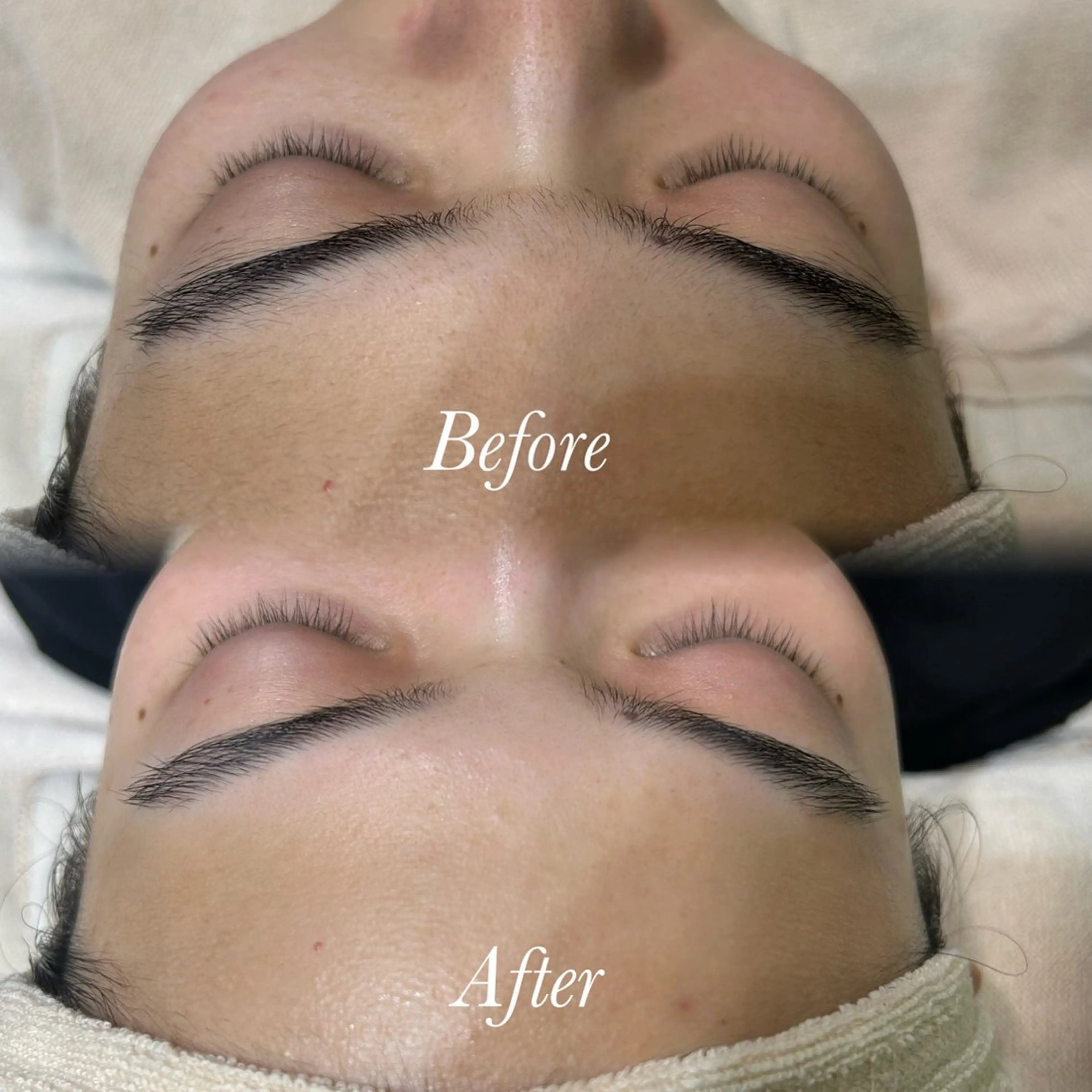 【動画撮影OKな方🎞⟡.·】顔シェービング+パックの写真