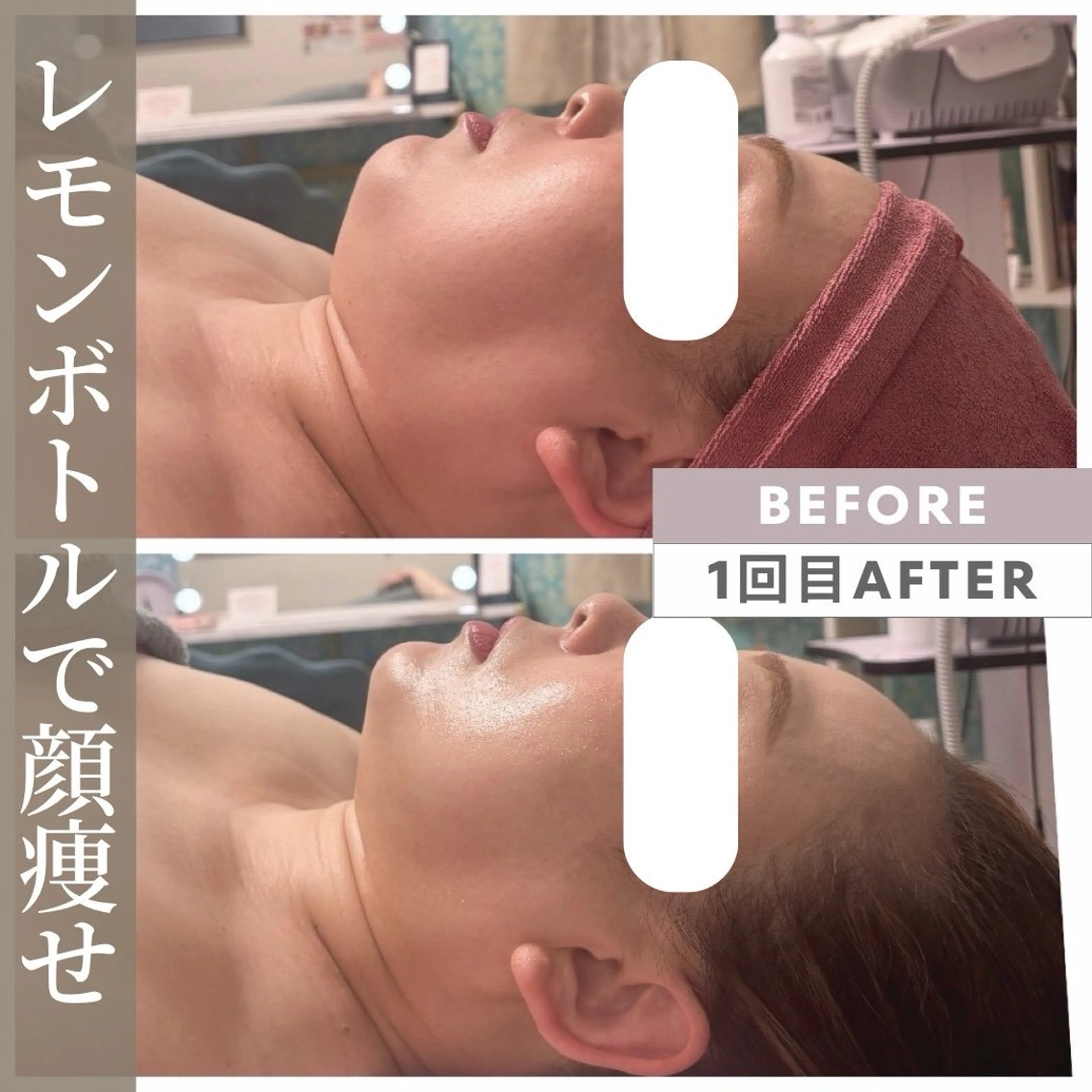 エステ リラク 【小顔リフト×小顔矯正専門店】RED所属・猿渡 ひかるのエステ・リラクイメージ