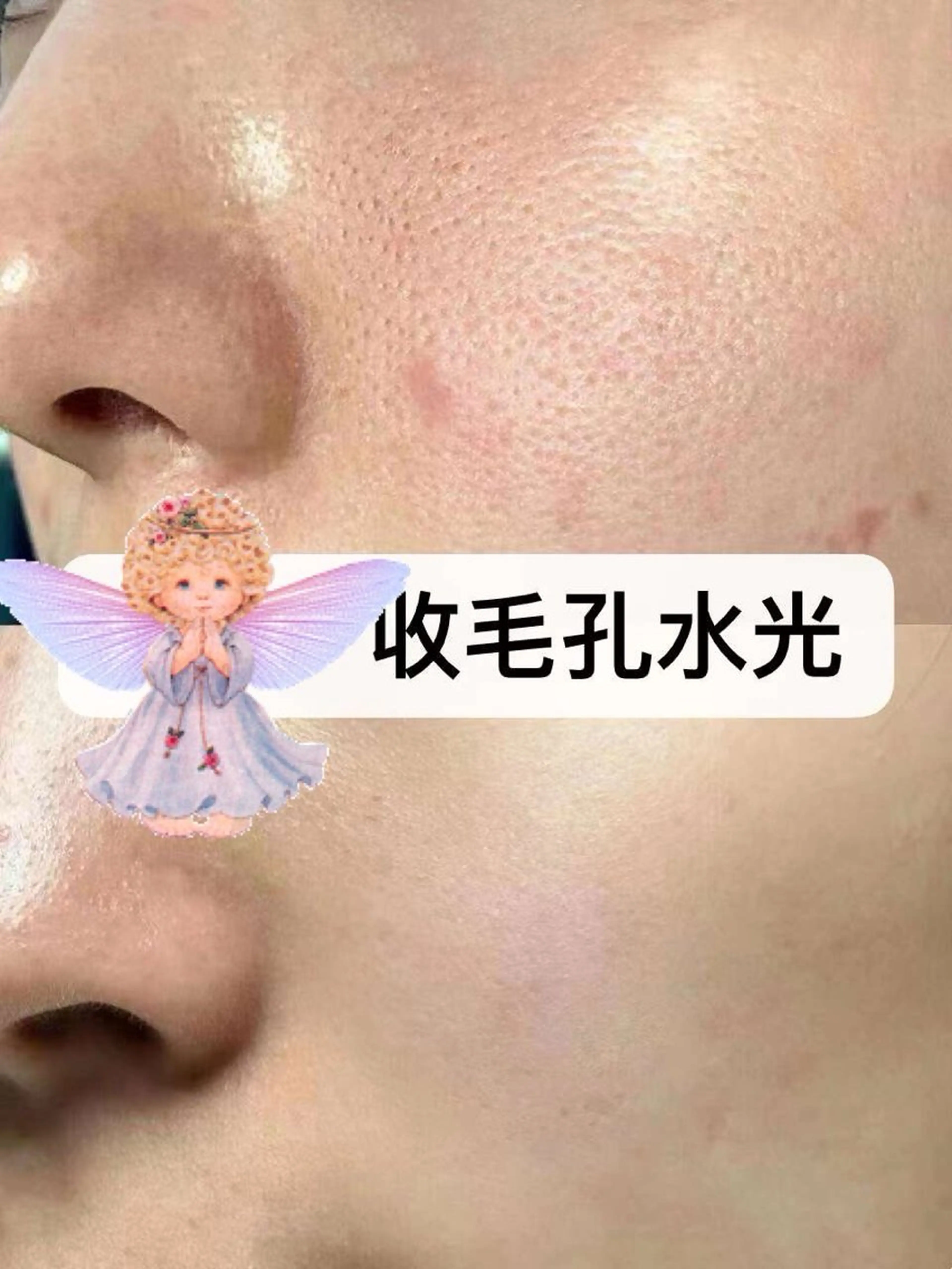 エステ リラク 愛維美水光美肌専門店所属・愛維美水光美肌専門店 メンズレディースokのエステ・リラクイメージ