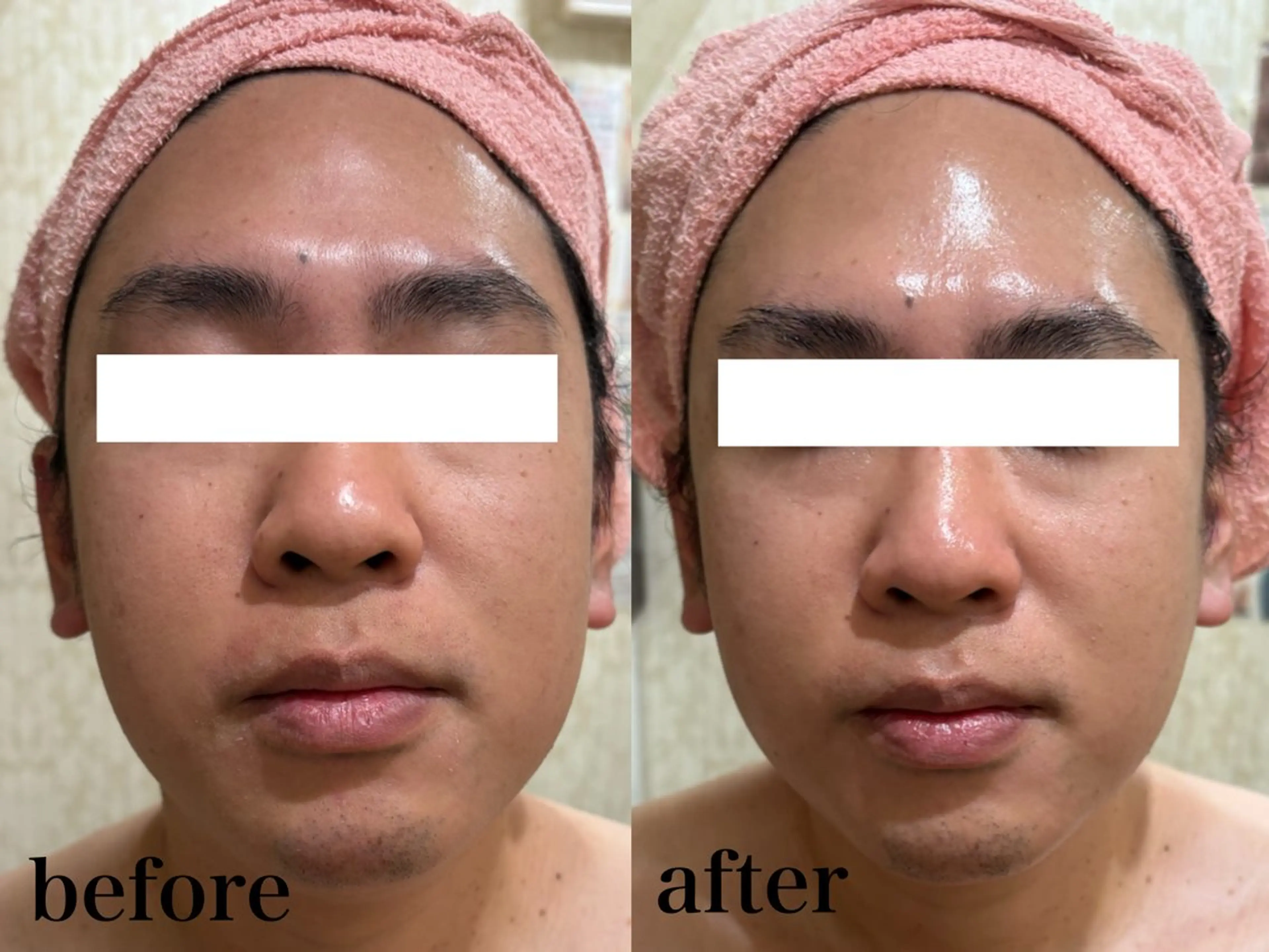 フェイシャル/脱毛 ジョアアンジェ　田中のエステ・リラクイメージ