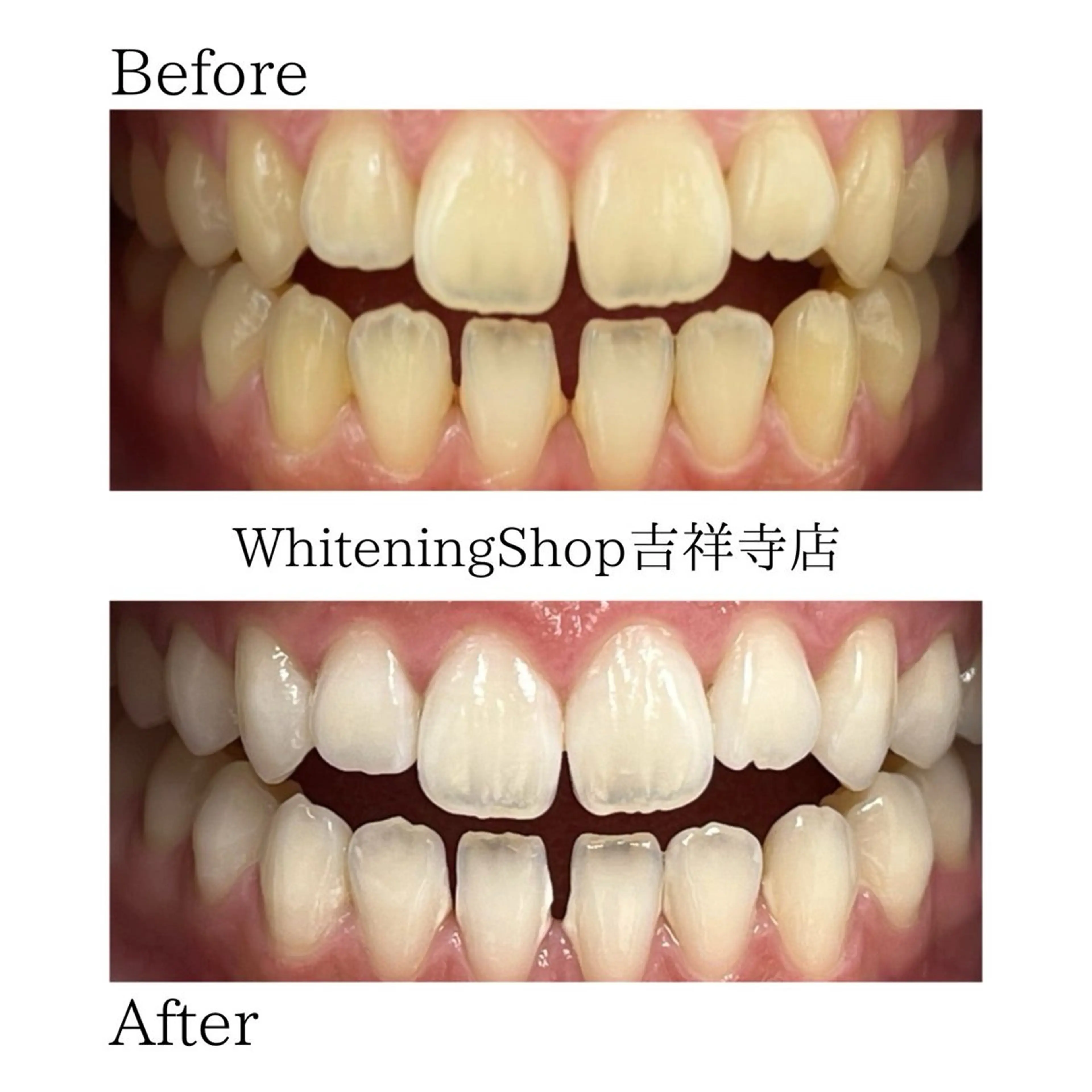 エステ リラク ホワイトニング ショップ吉祥寺店のエステ・リラクイメージ