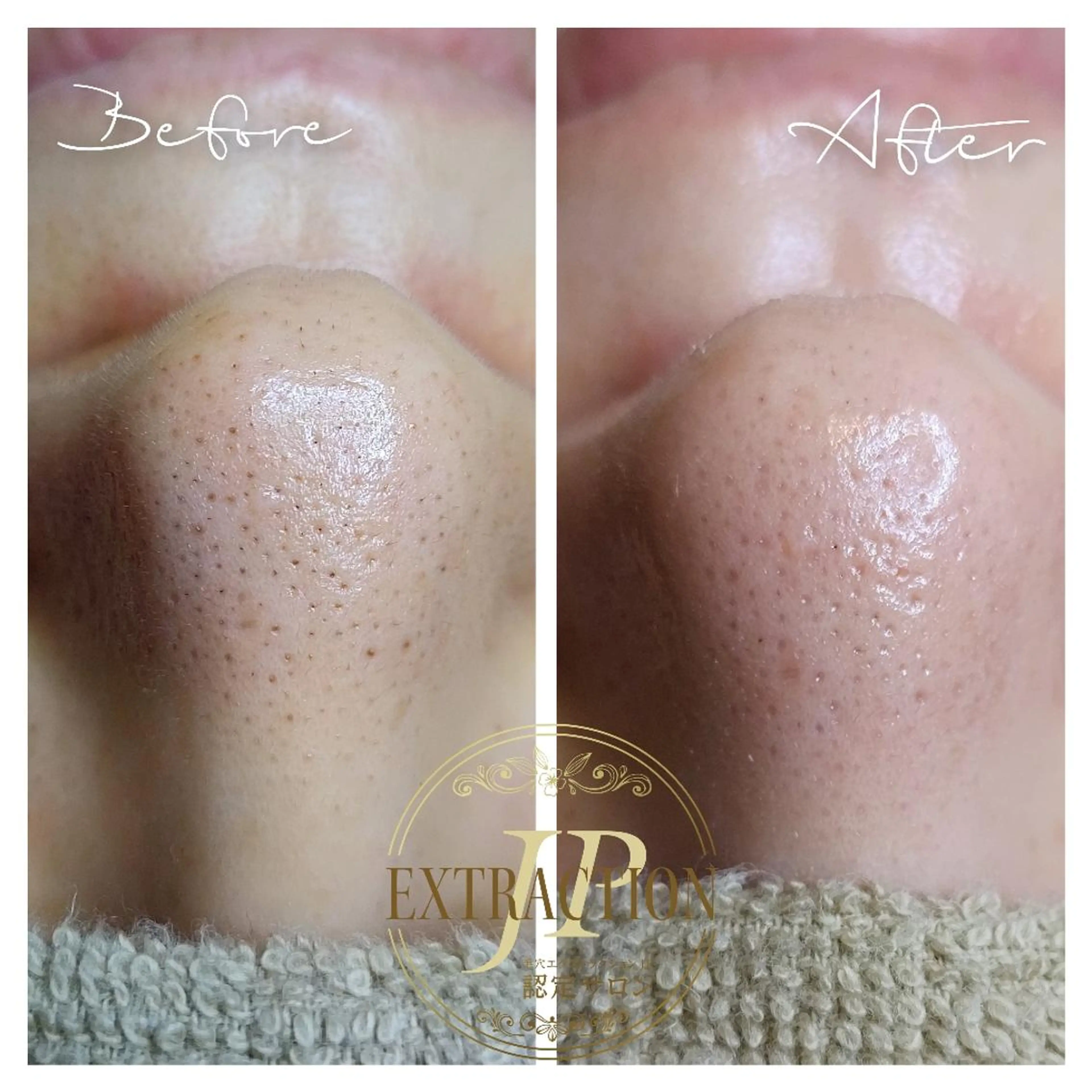 エステ エステサロン　Lazulisea所属・川口 春奈のエステ・リラクイメージ