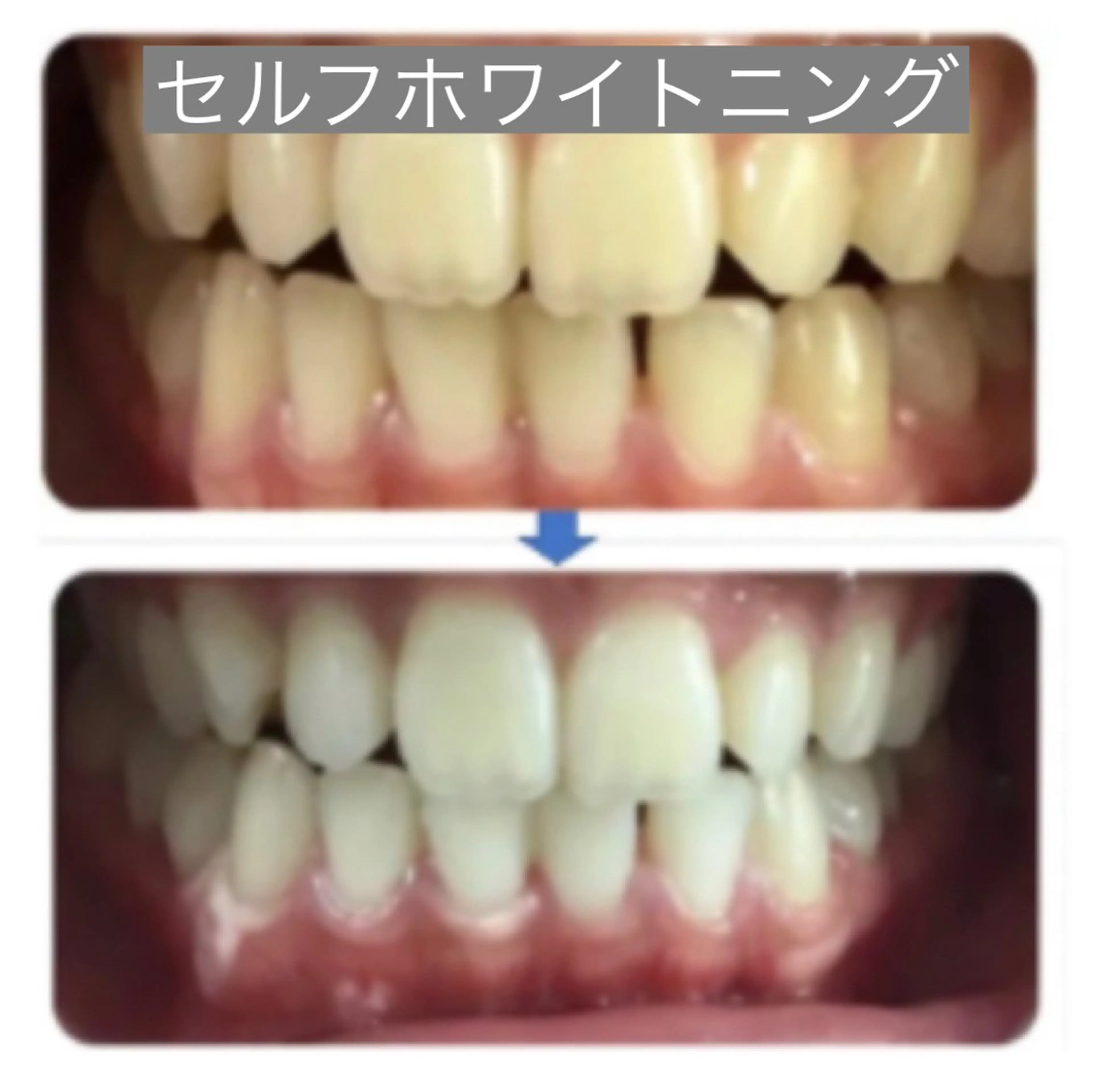 R.S.Land メンズ脱毛/エステのエステ・リラクイメージ