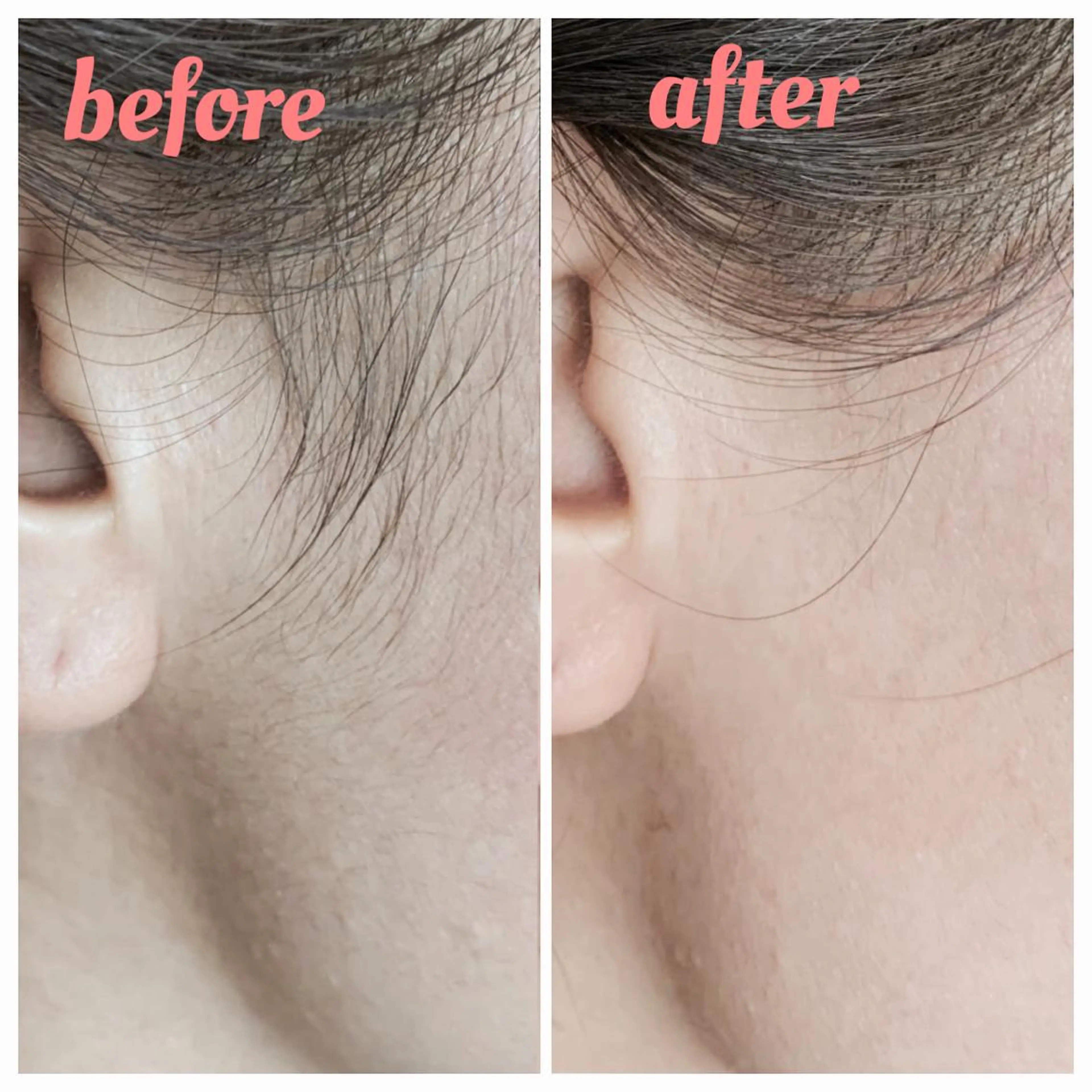 脱毛 脱毛サロンLULA 恵比寿店　笠松のエステ・リラクイメージ