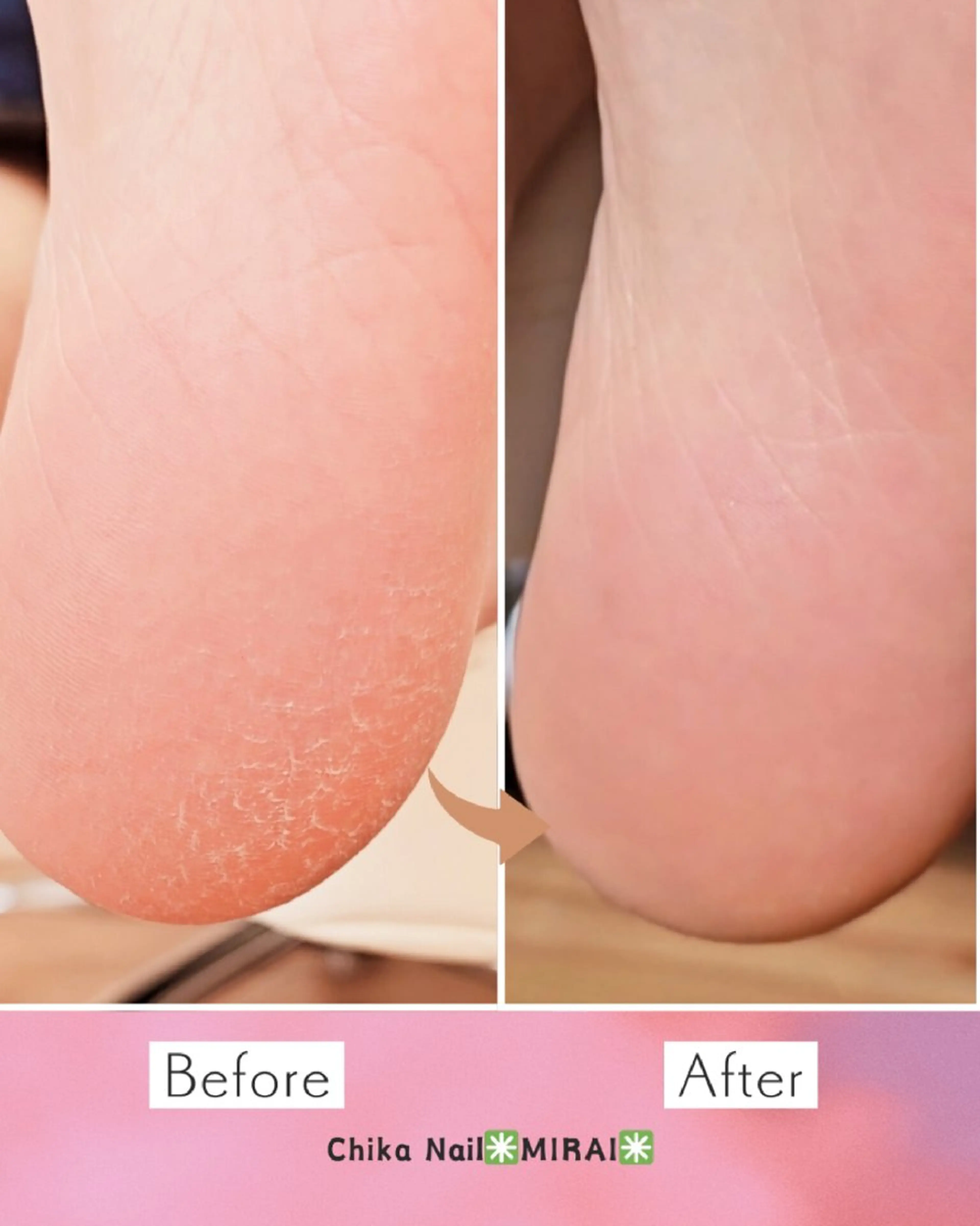 ネイル Chika  Nail MIRAIのネイルデザイン