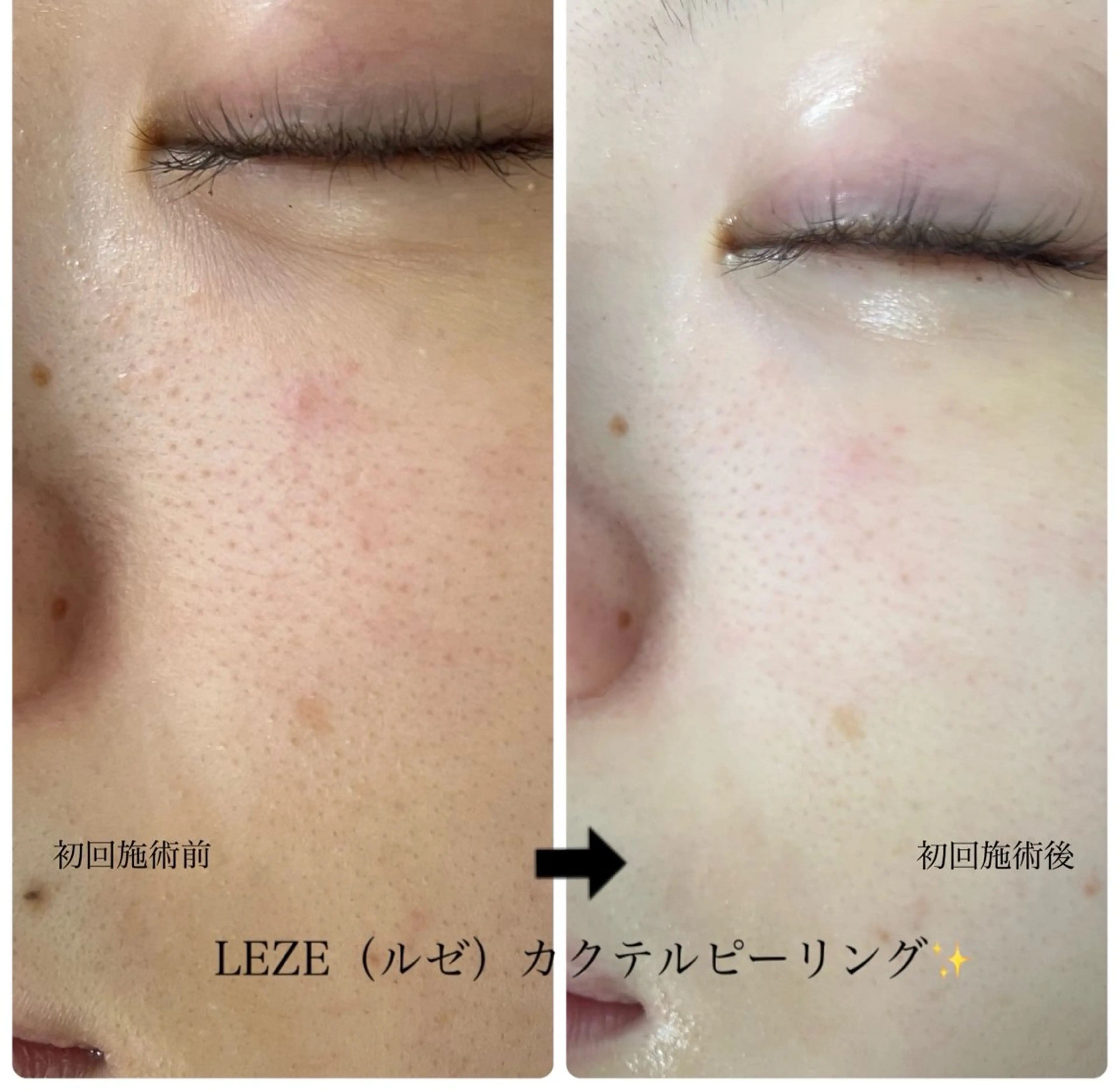 🩵Tatsumi Kana🩵のエステ・リラクイメージ