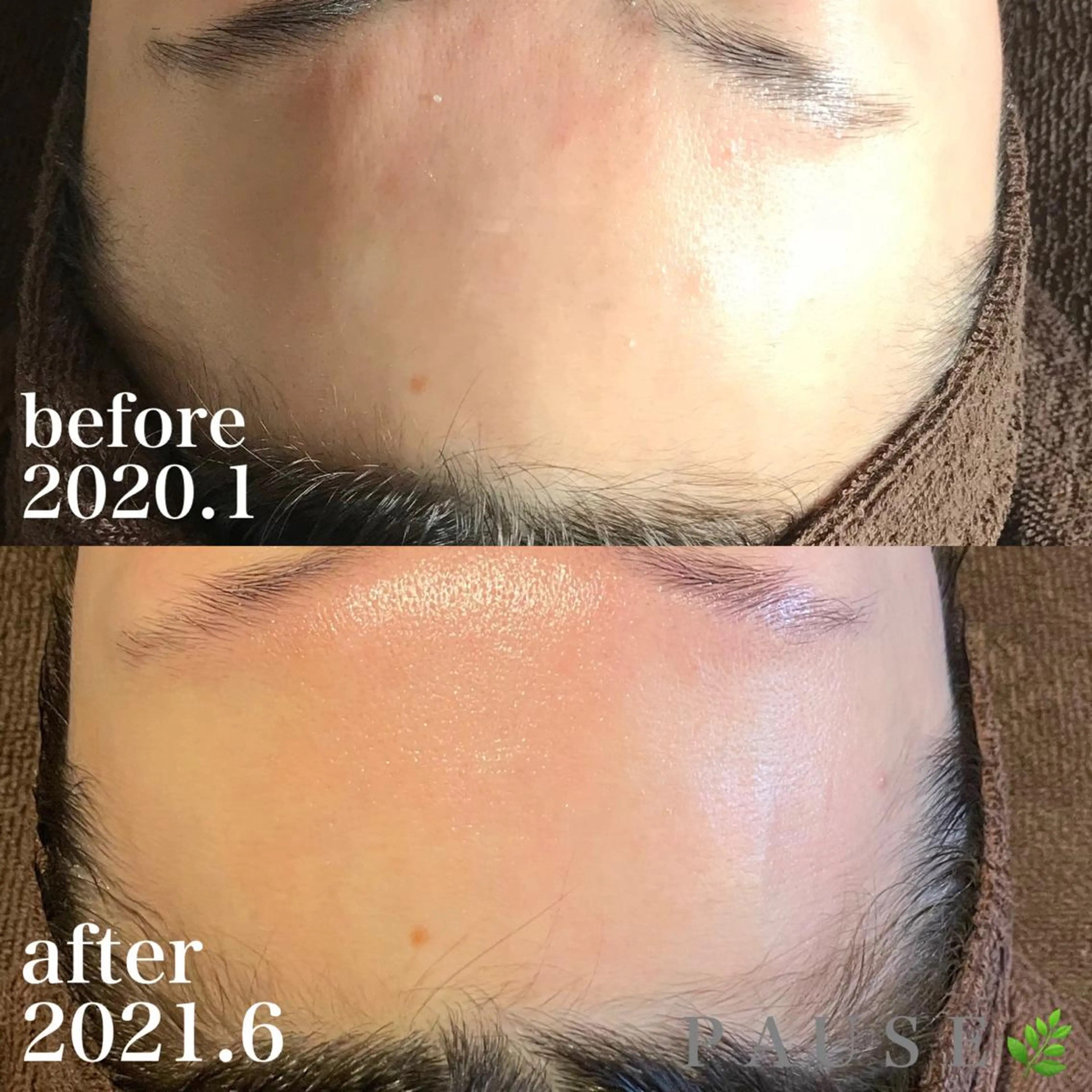 エステ 浜野 恵美のエステ・リラクイメージ