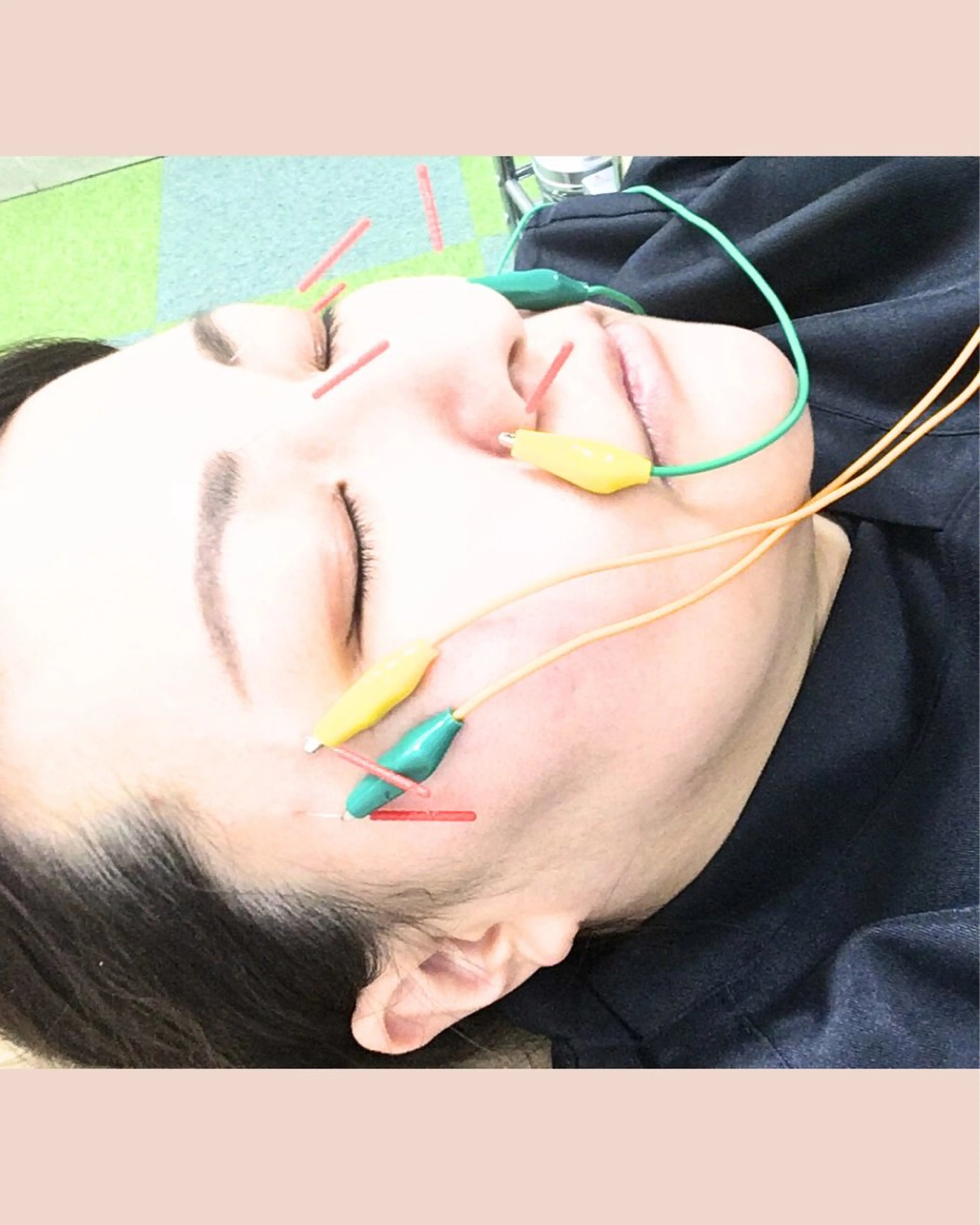 エステ リラク まごころ鍼灸整骨院所属・まごころ鍼灸整骨院 京王堀之内院のエステ・リラクイメージ