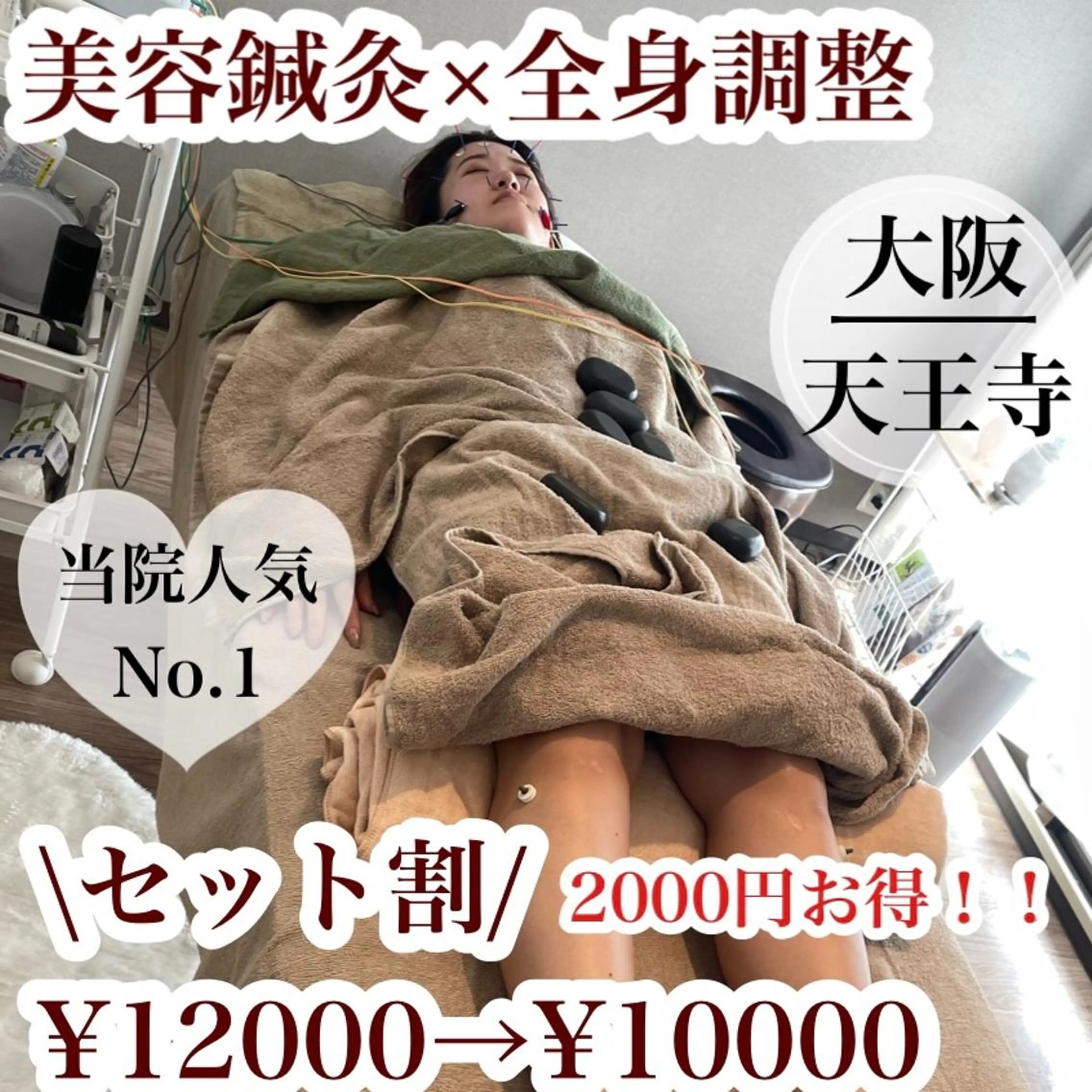 美容鍼灸×鍼灸全身(組み合わせ)の写真