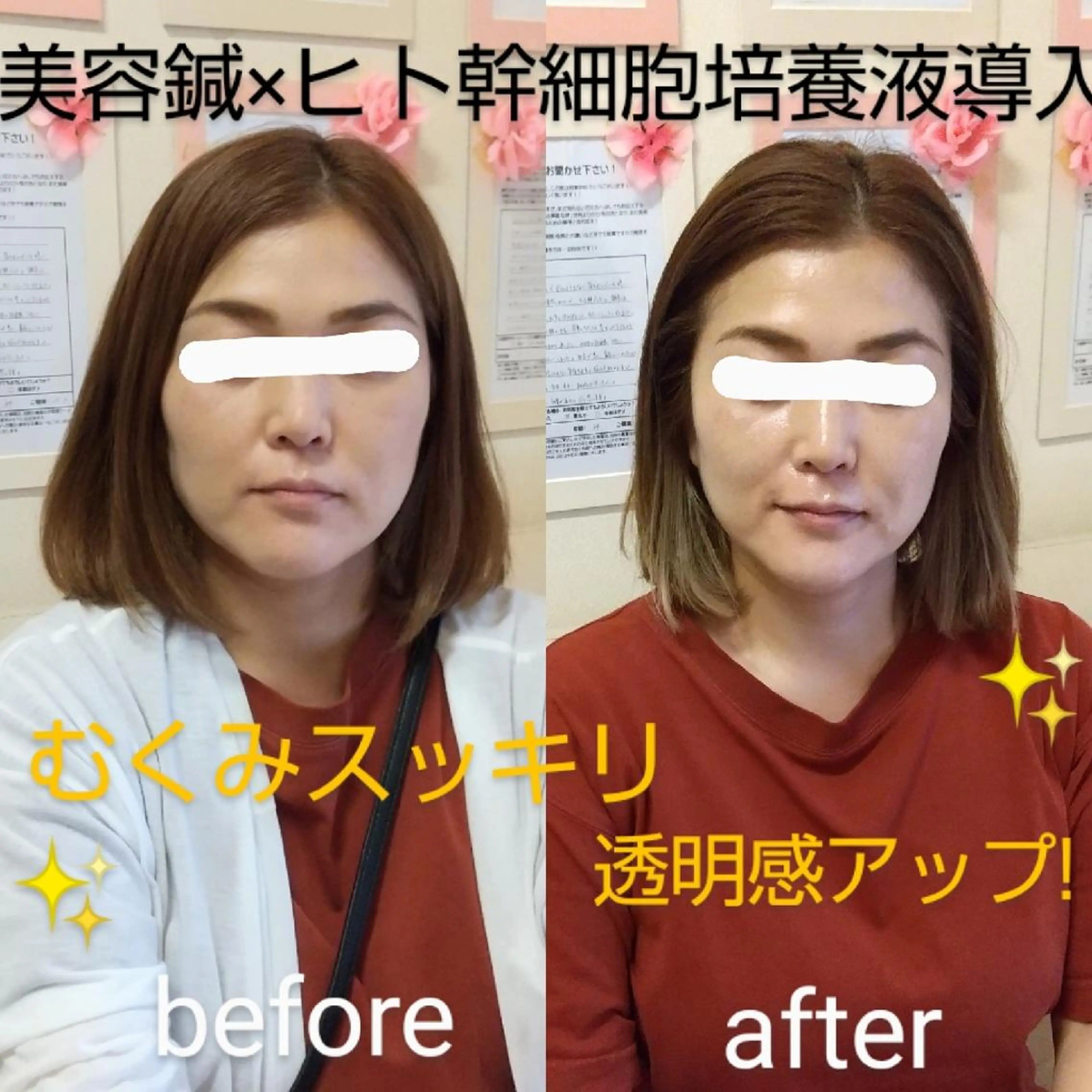 【妊活・美容鍼専門】Aran鍼灸院所属・【美容鍼・不妊専門】 Aran鍼灸院のエステ・リラクイメージ