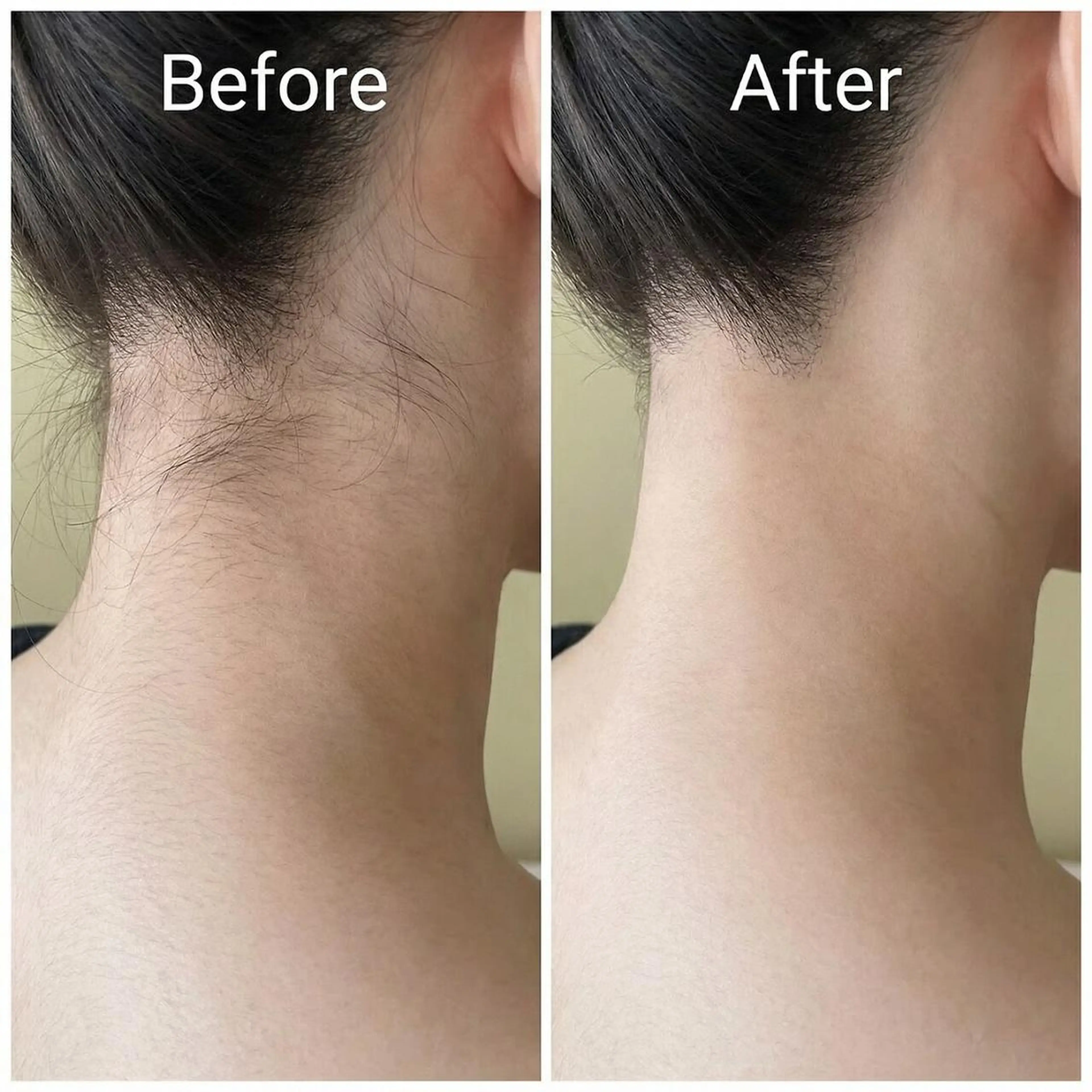 エステ 脱毛×肌管理サロン ルネルのエステ・リラクイメージ