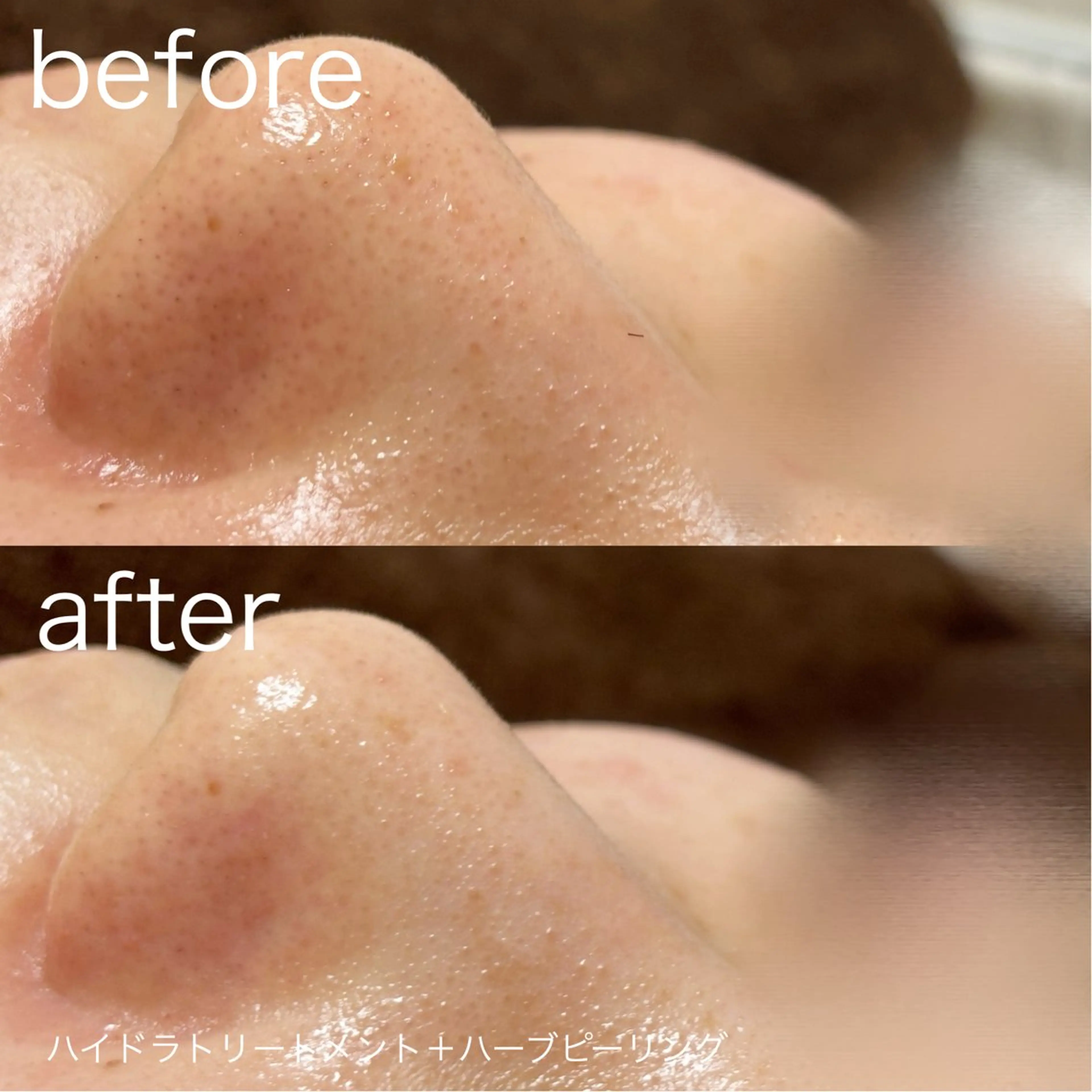 その他 lulularico Yuのエステ・リラクイメージ