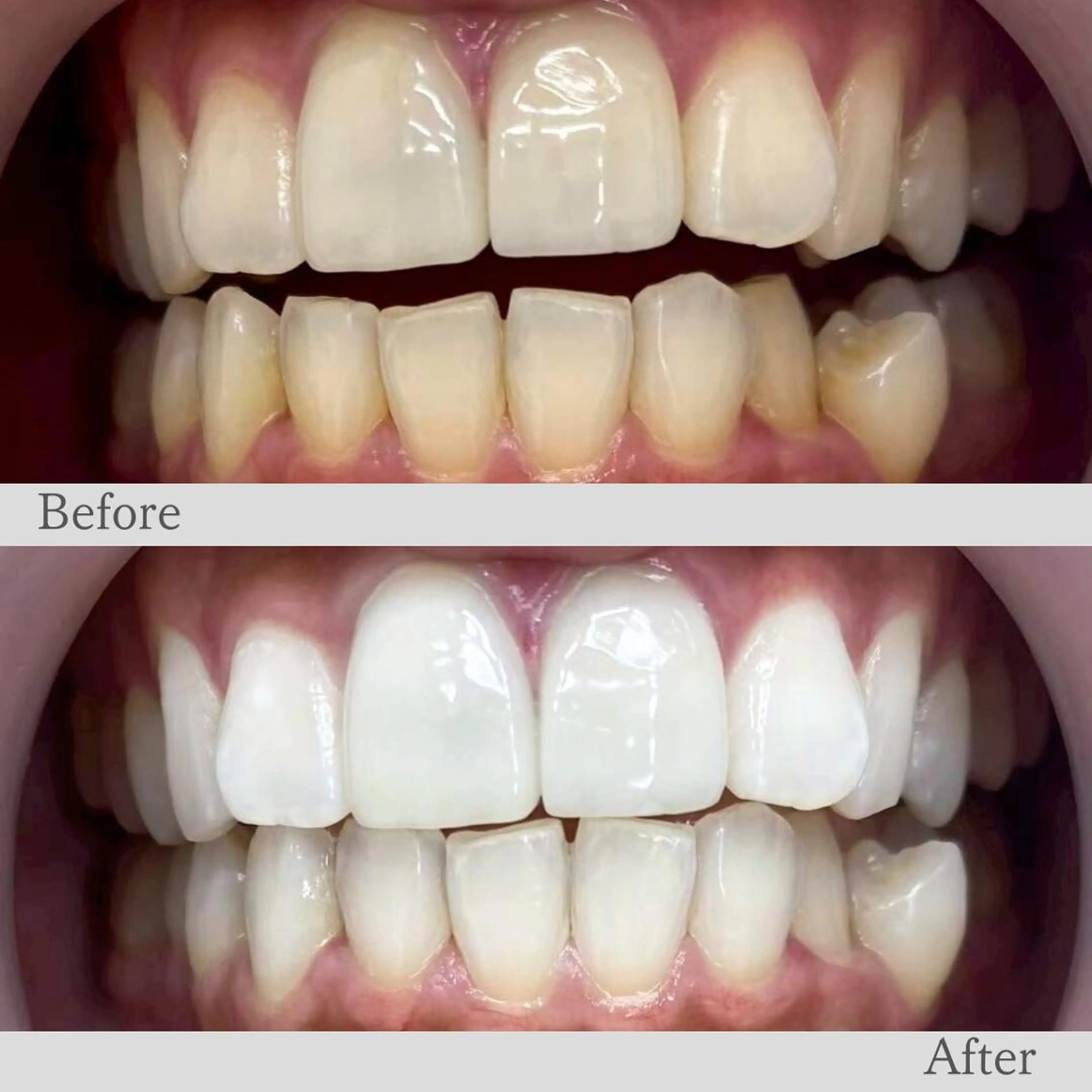 エステ リラク LBS吉祥寺 公式のエステ・リラクイメージ