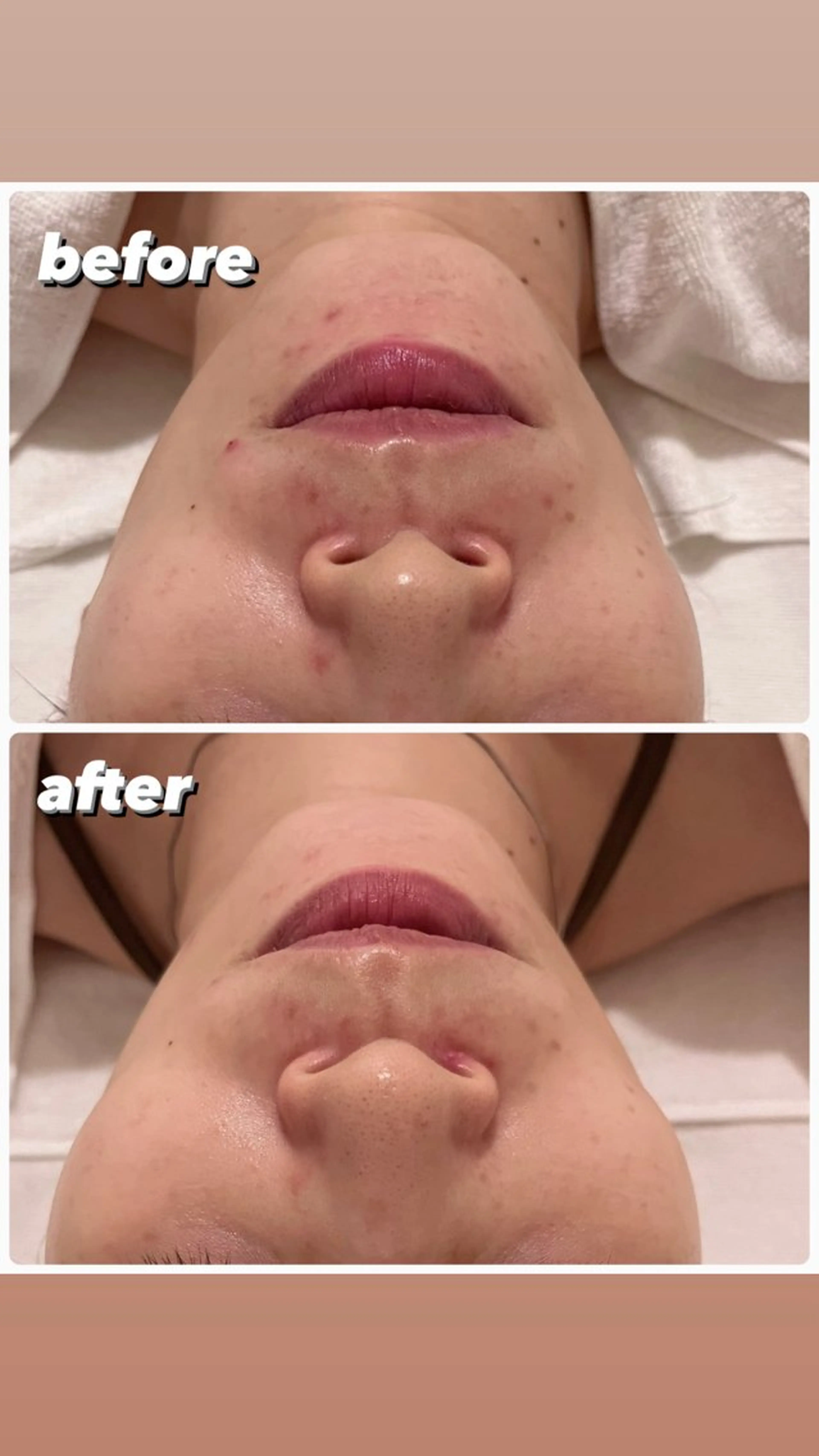 エステ POLA THE BEAUTY 堺東店所属・肌管理🌿毛穴改善 POLA堺東のエステ・リラクイメージ