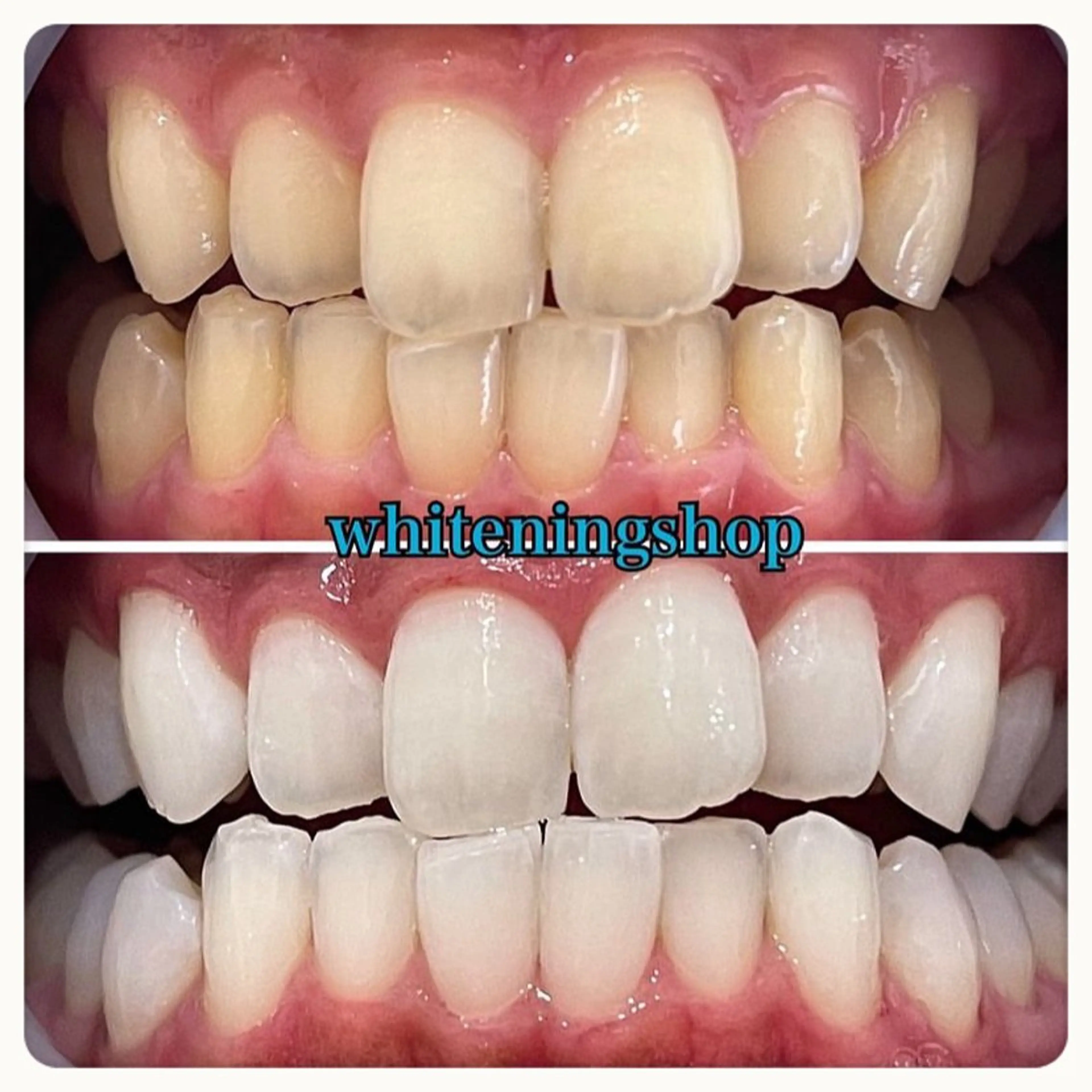 エステ リラク ホワイトニング ショップ吉祥寺店のエステ・リラクイメージ