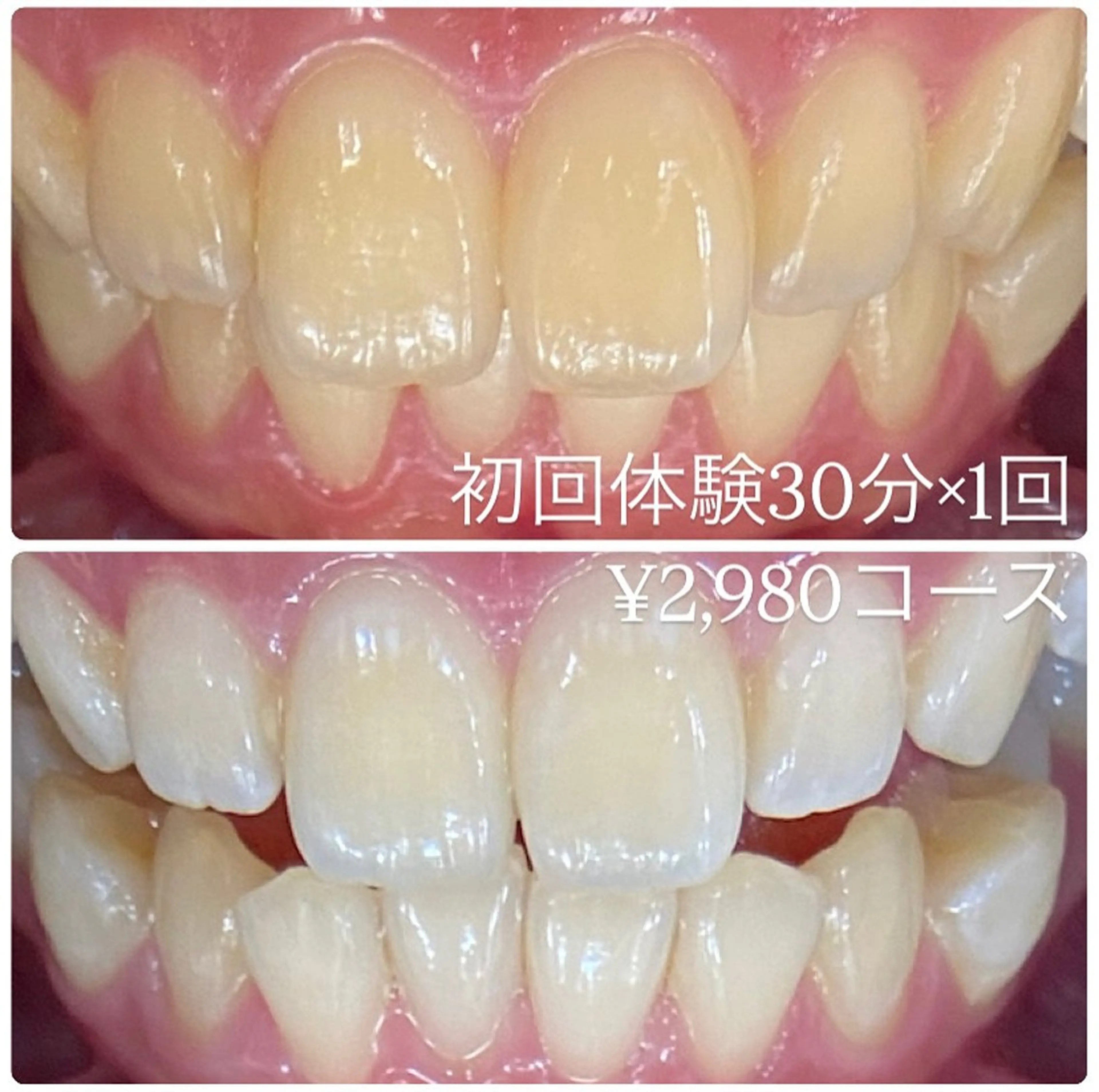 PLATINUM Beauty 横浜店所属・ホワイトニングルーム 横浜店のその他イメージ