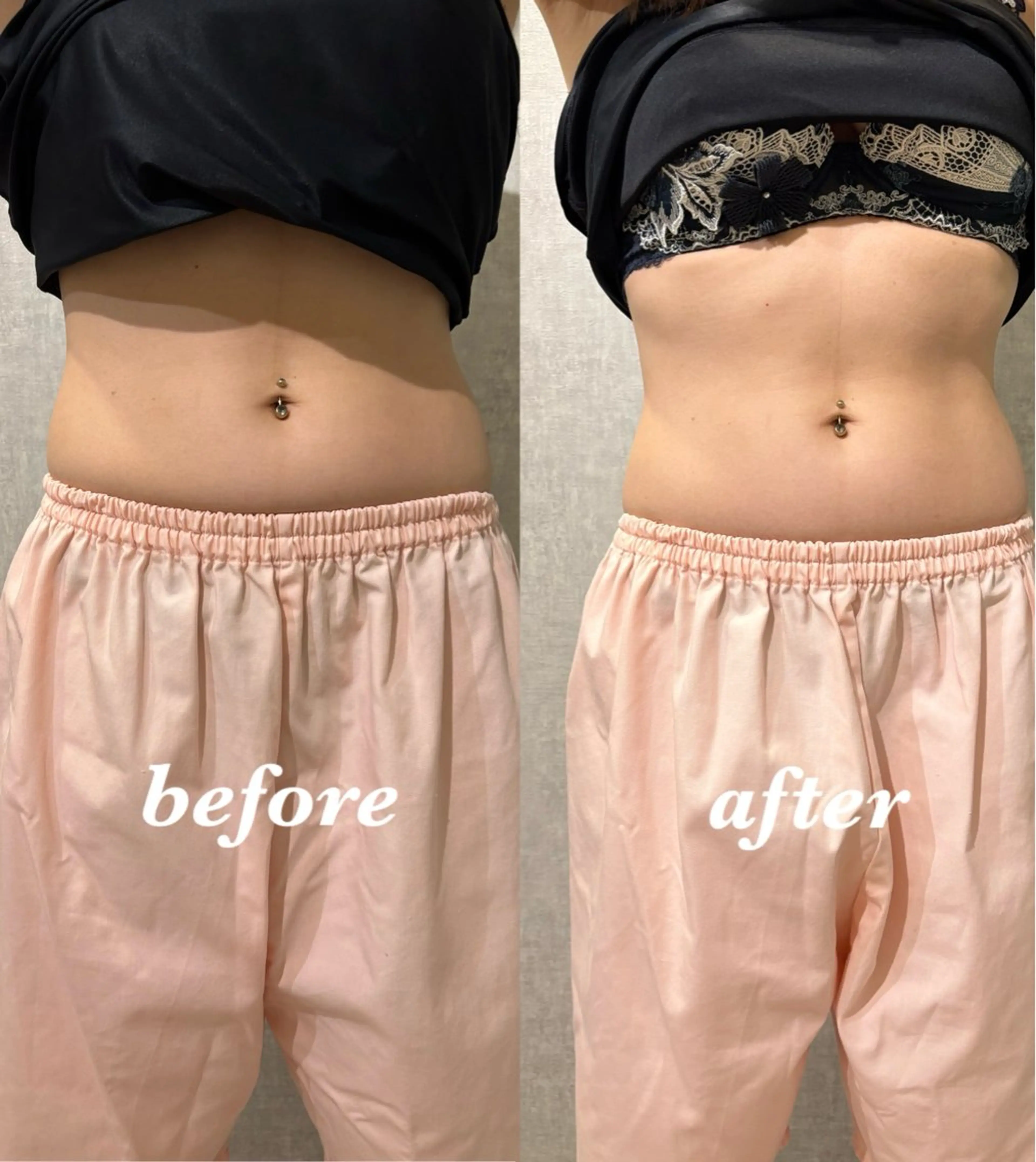 その他 腸活サポート みなみののエステ・リラクイメージ