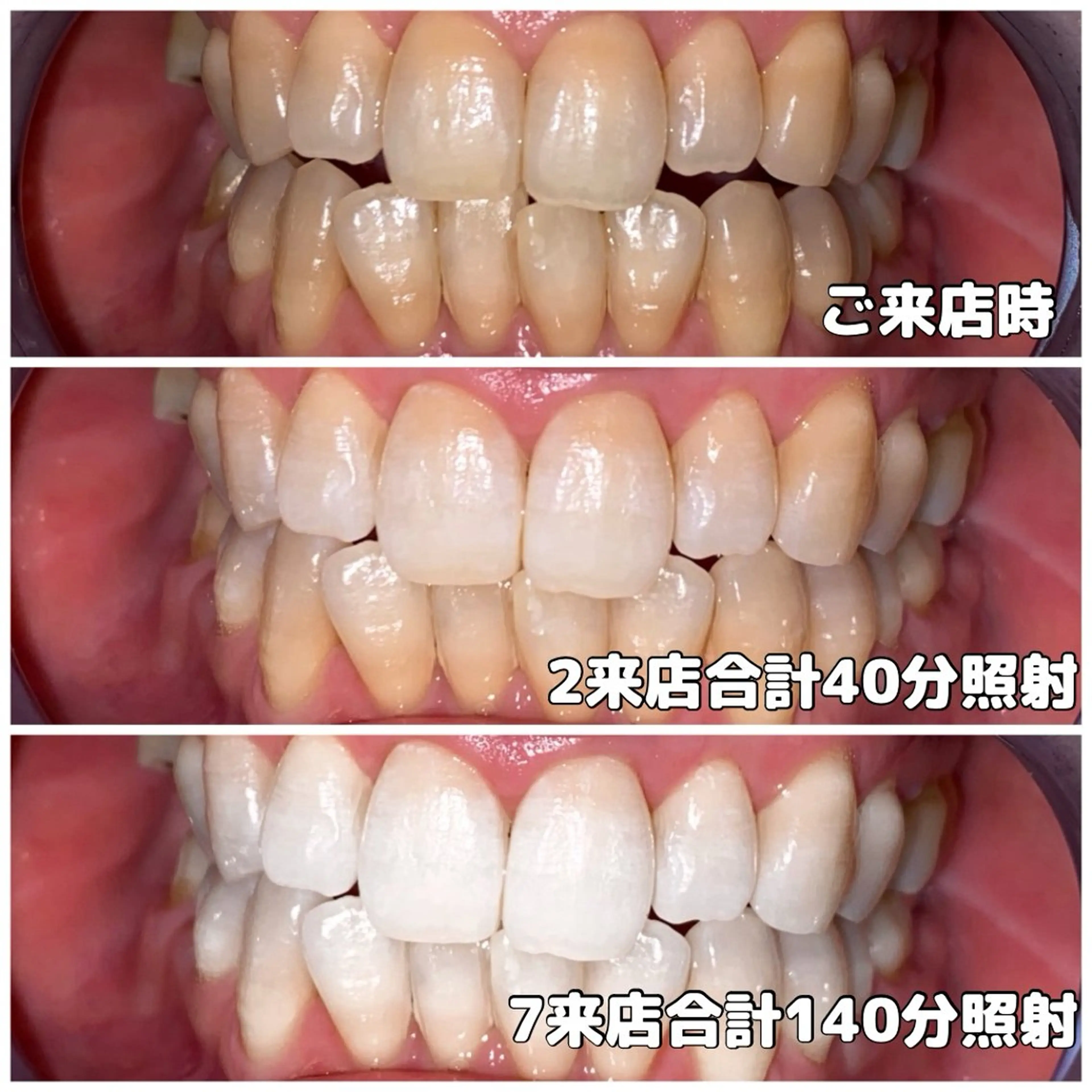 LIGHT Beauty 関内店所属・ライトビューティー 関内店のその他イメージ