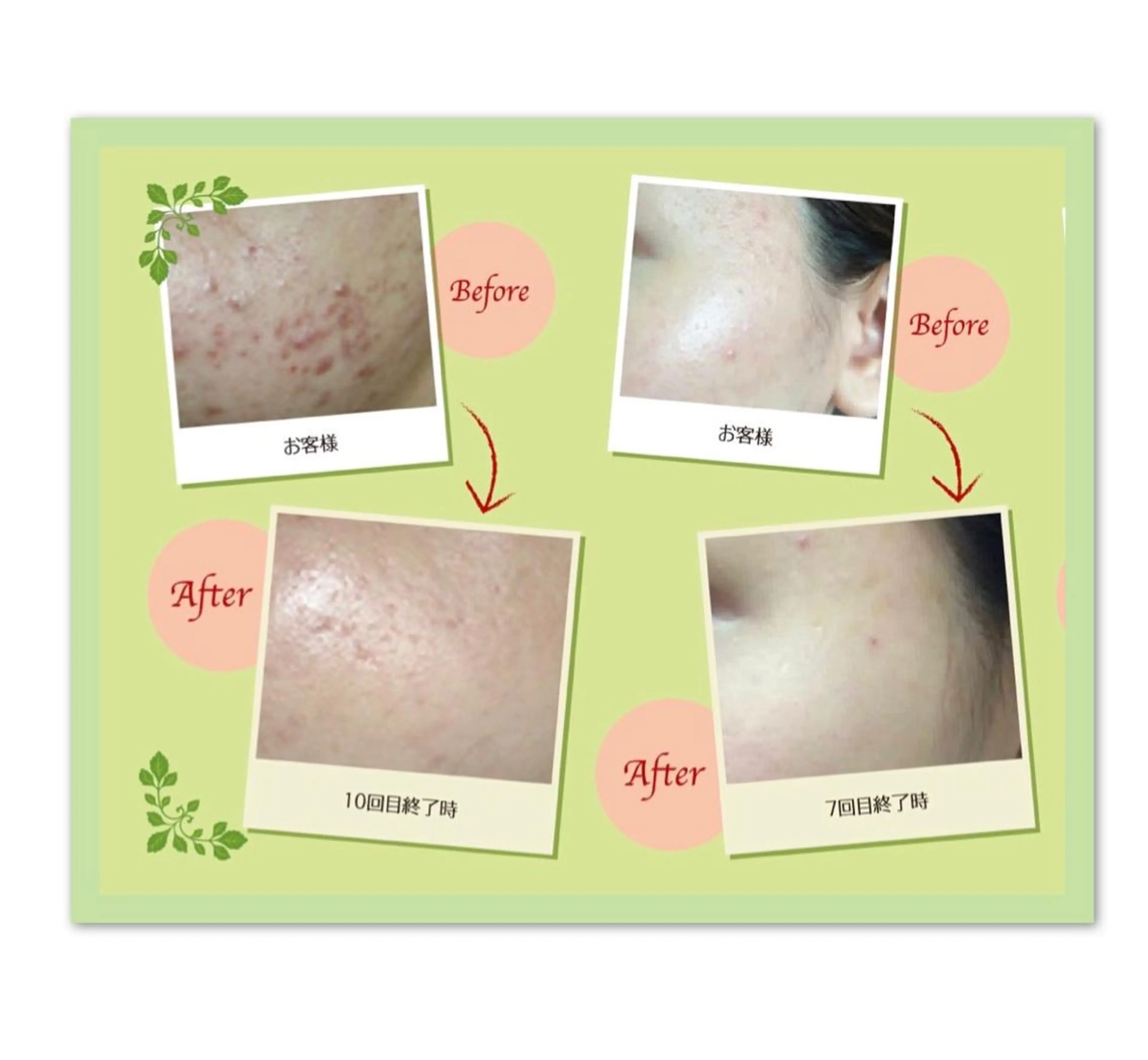 平岡 ゆかりのエステ・リラクイメージ