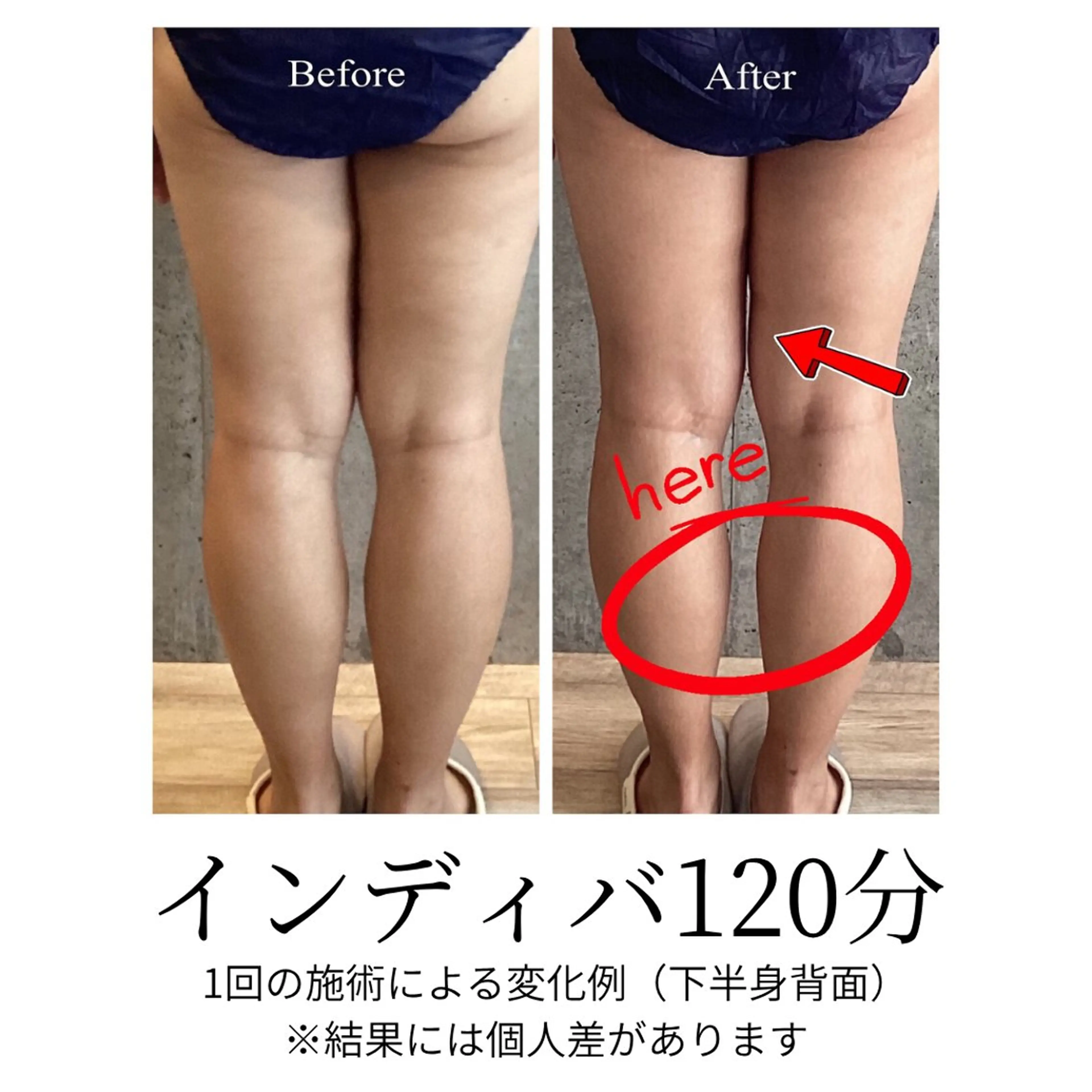 さくらんぼ鍼灸院所属・美容鍼&温活・免活 さくらんぼ鍼灸院のエステ・リラクイメージ