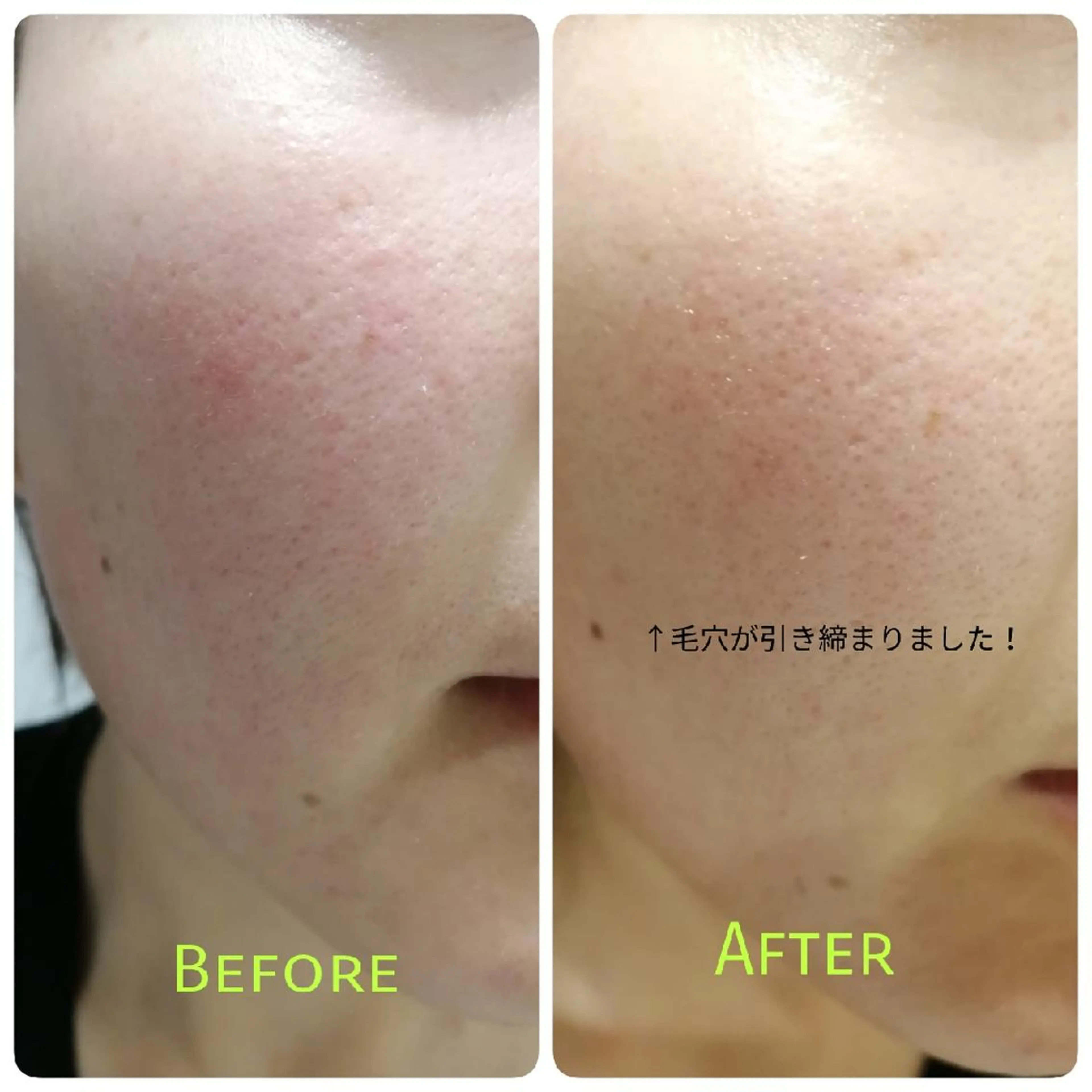 エステ アロマとハーブエステ GARDENのエステ・リラクイメージ