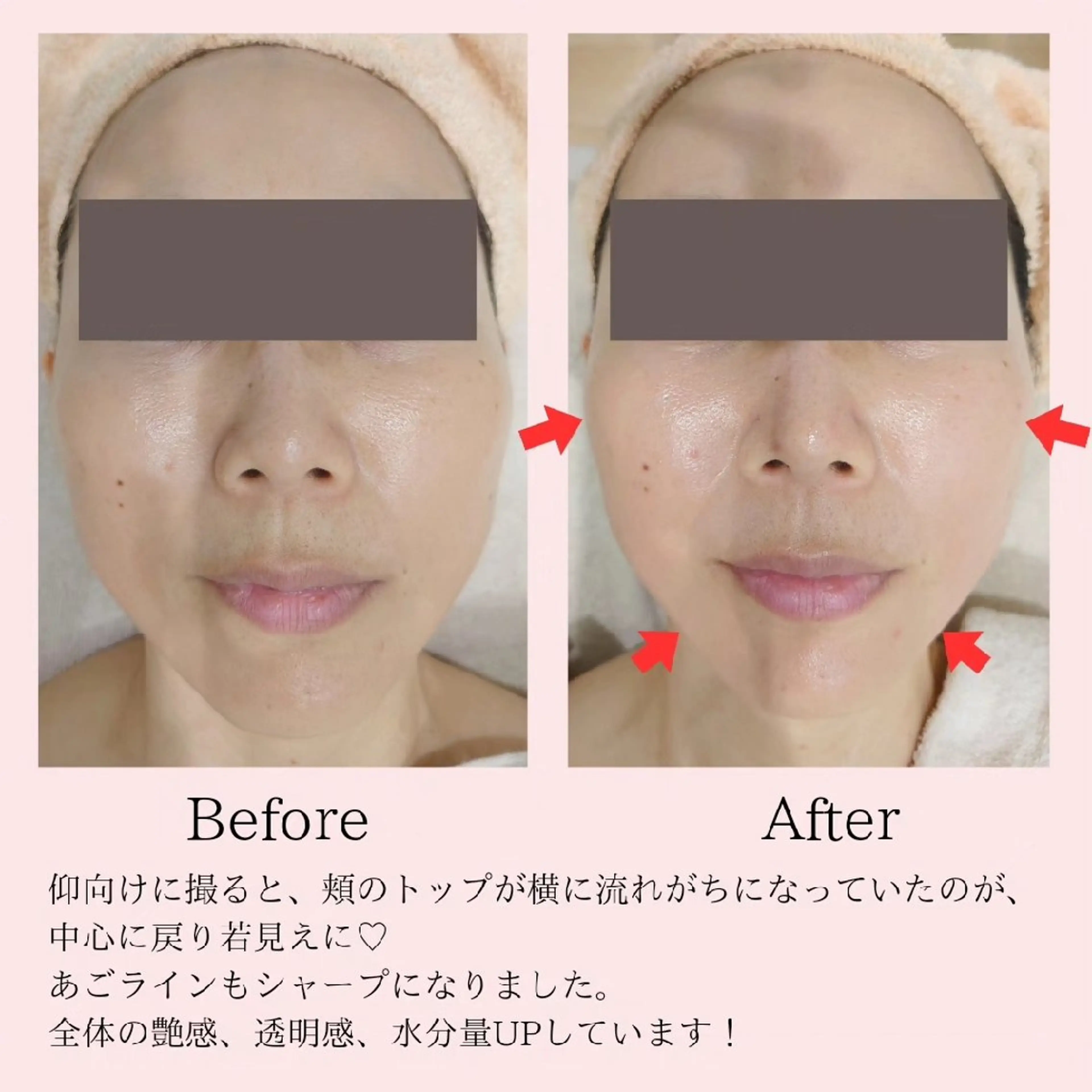 エステ PRETTIEST SHINE所属・フェイシャル/ボディ /ブライダル山田浩子のエステ・リラクイメージ