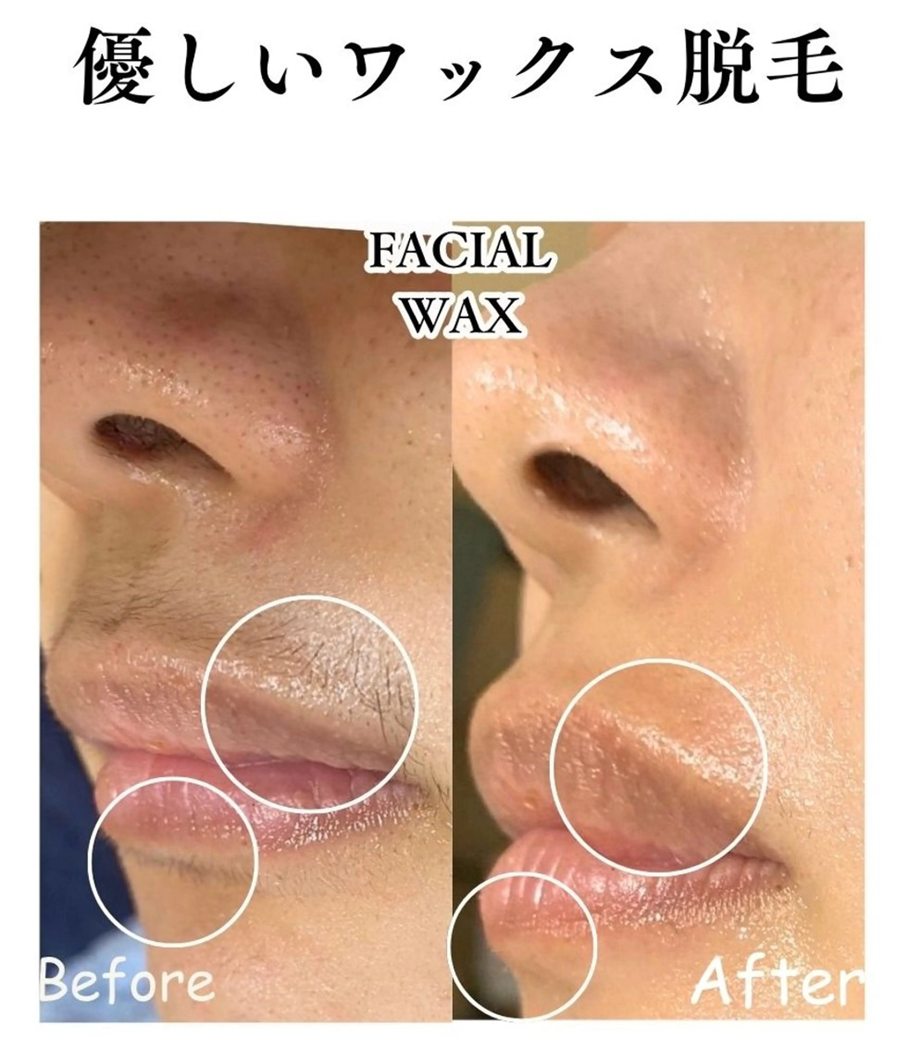 フェイシャルワックス（マリムーブ）の写真