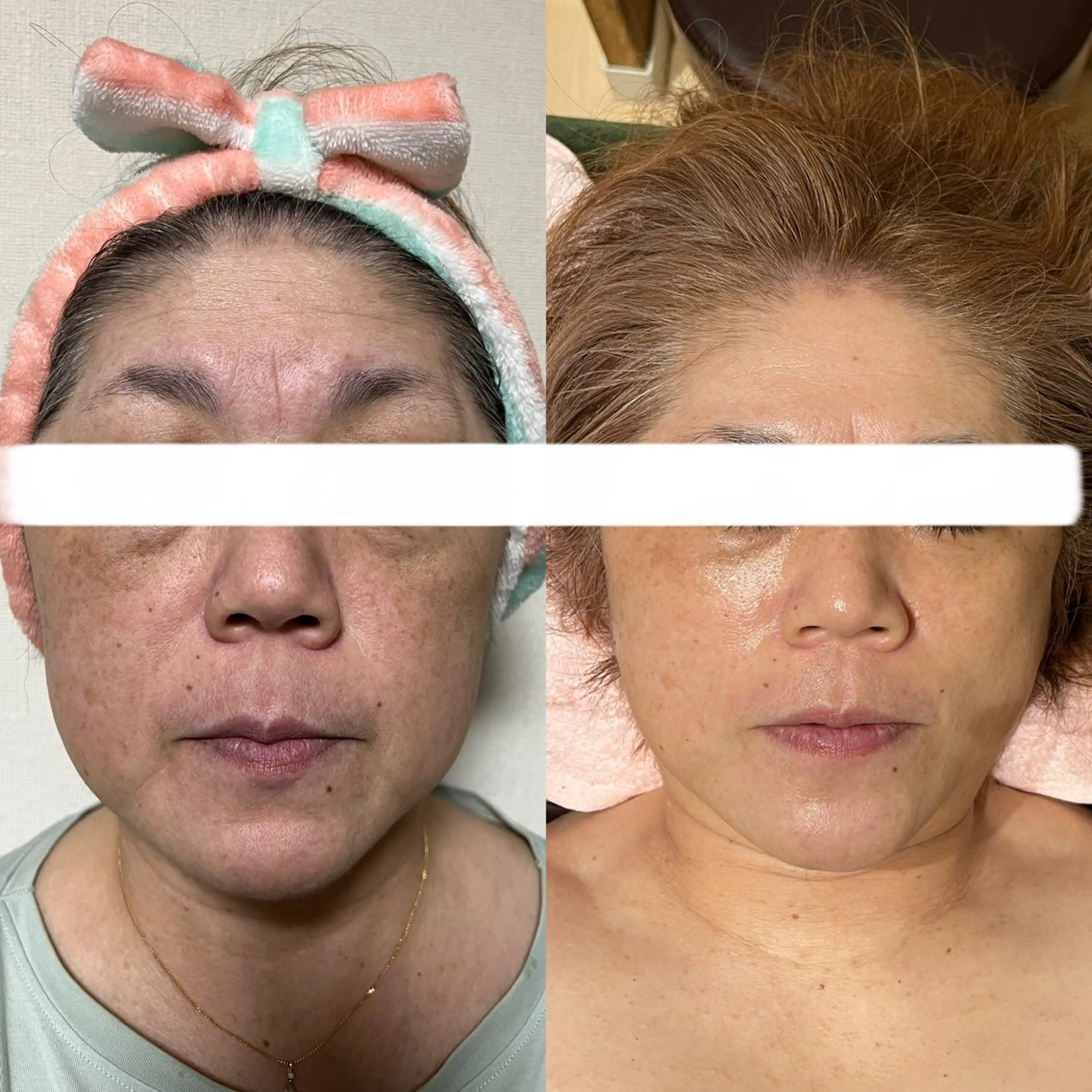 エステ Relaxation SalonARONAのエステ・リラクイメージ