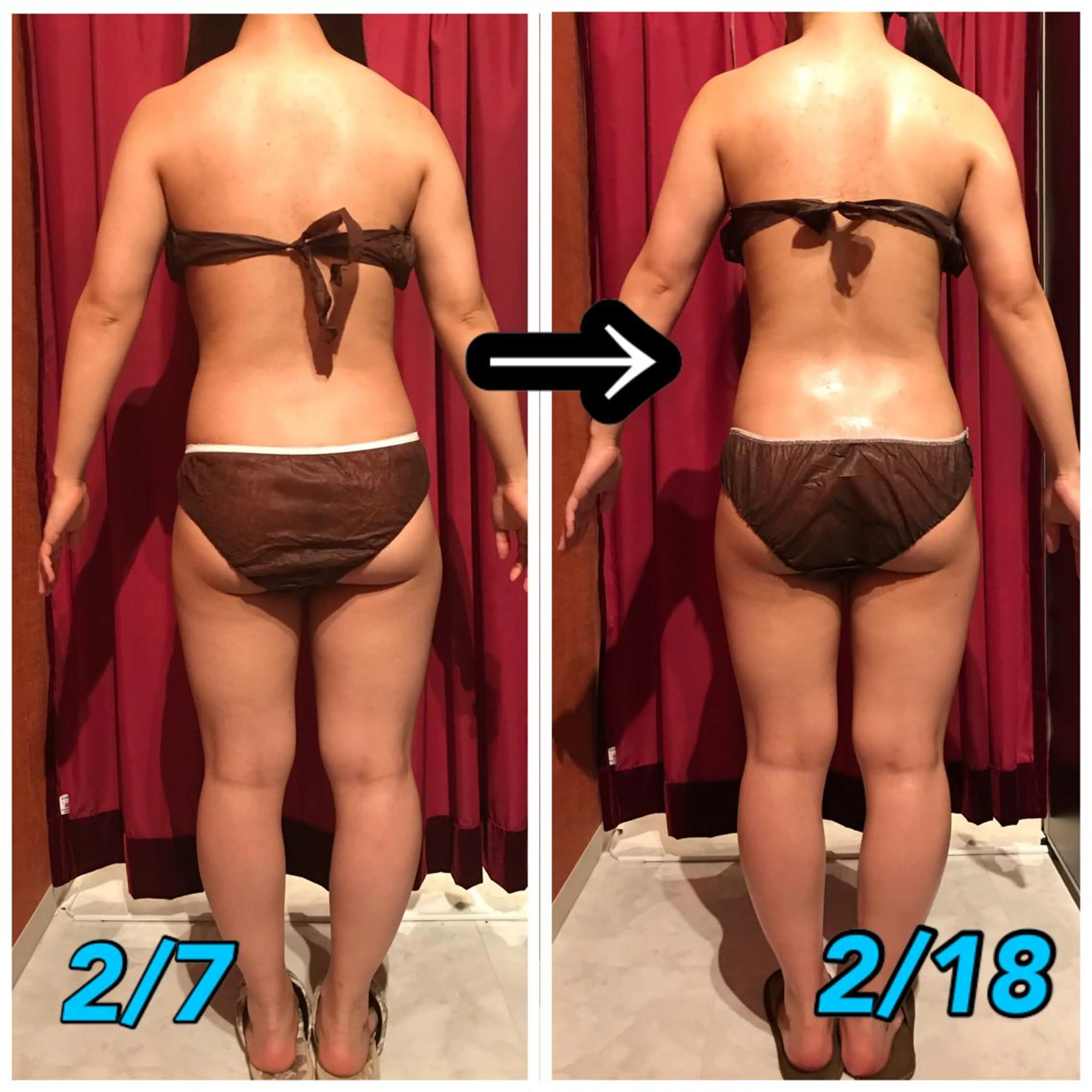 Cielo(シエロ) ダイエット専門店のエステ・リラクイメージ