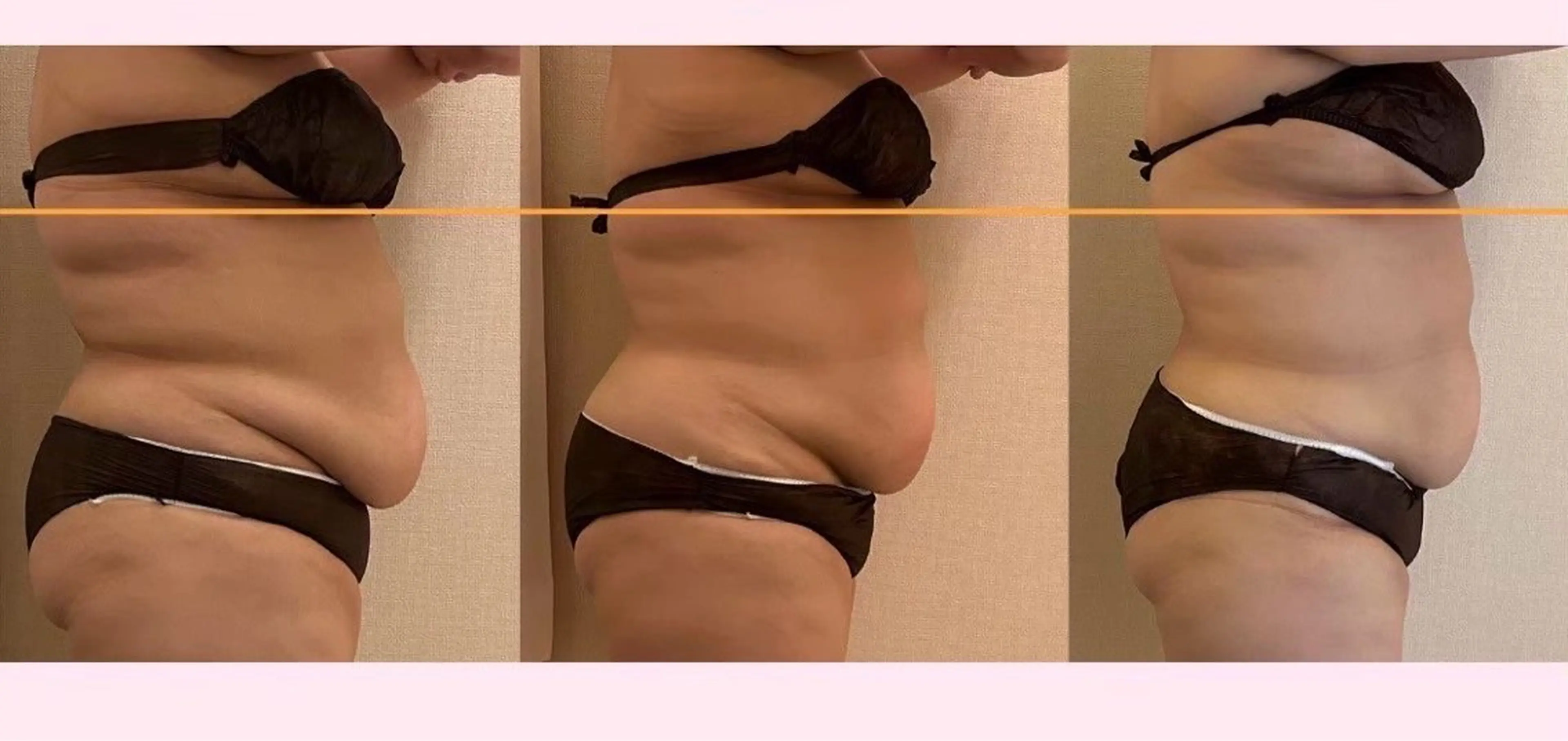 極上プレミアムコースの写真