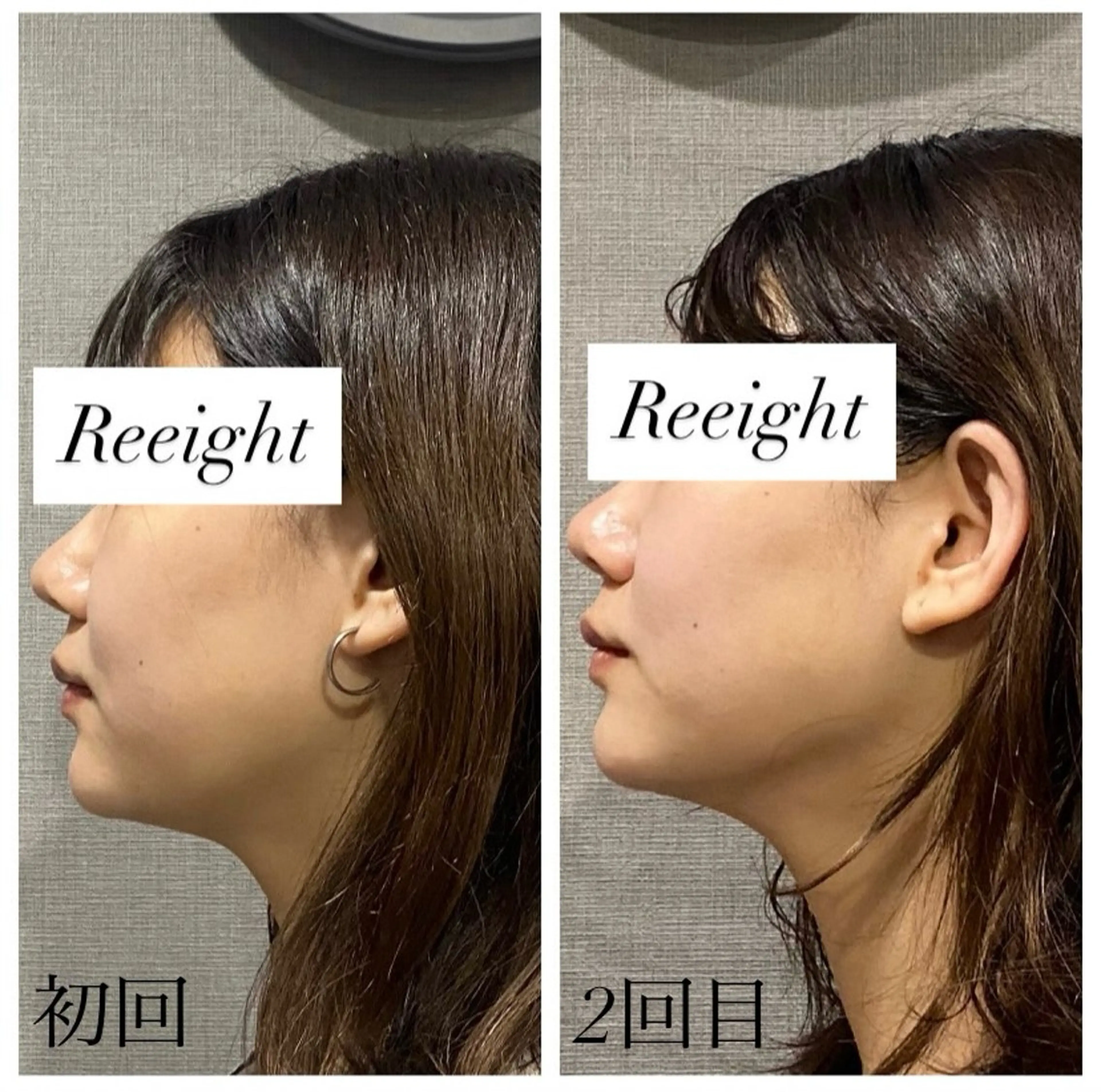 エステ 肌質改善専門 ハーブ /毛穴洗浄 リエイトのエステ・リラクイメージ