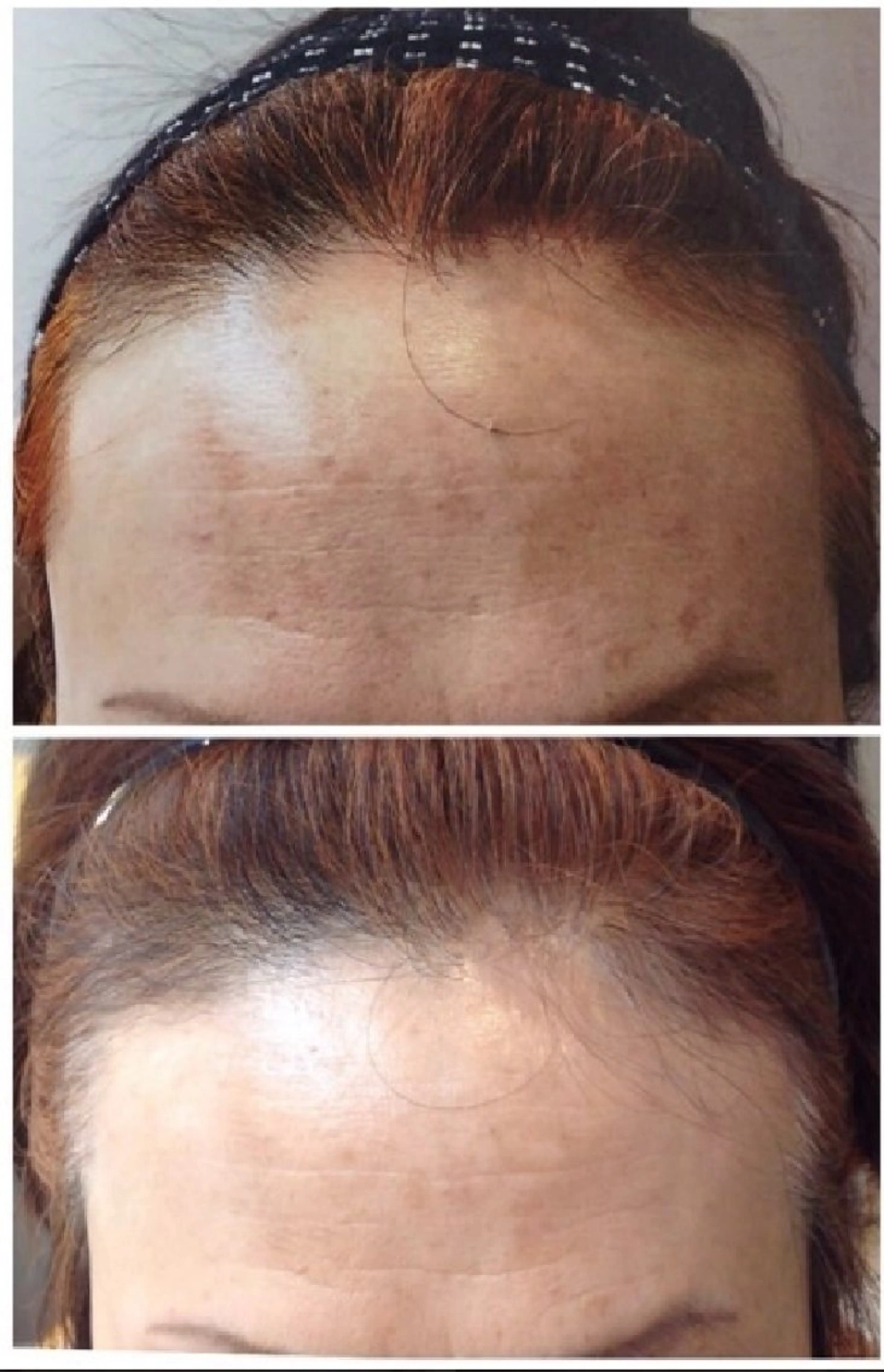 エステ LOUISE.／脱毛所属・LOUISE. ／脱毛のエステ・リラクイメージ