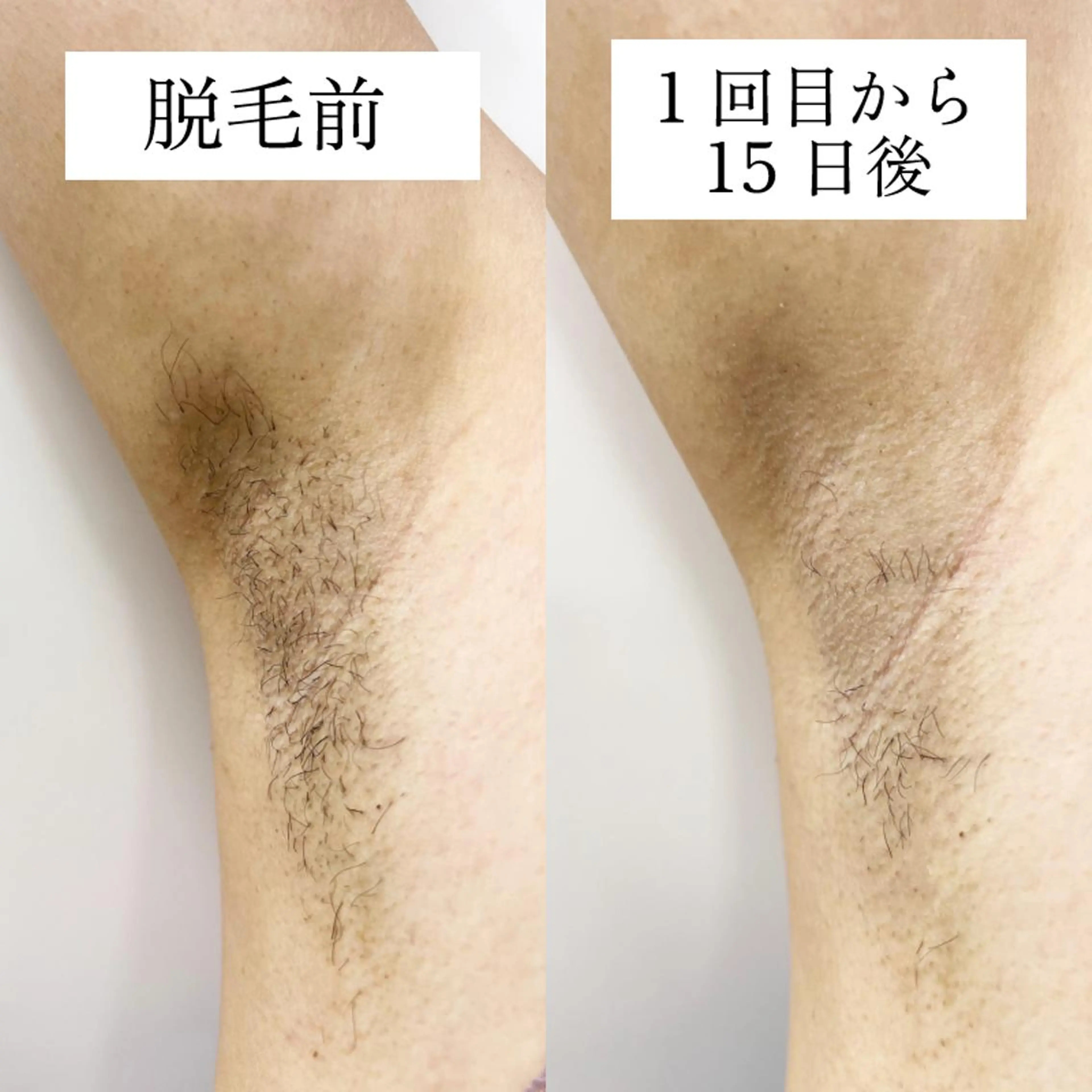 ダイエットラボ梅田店 🌟のエステ・リラクイメージ