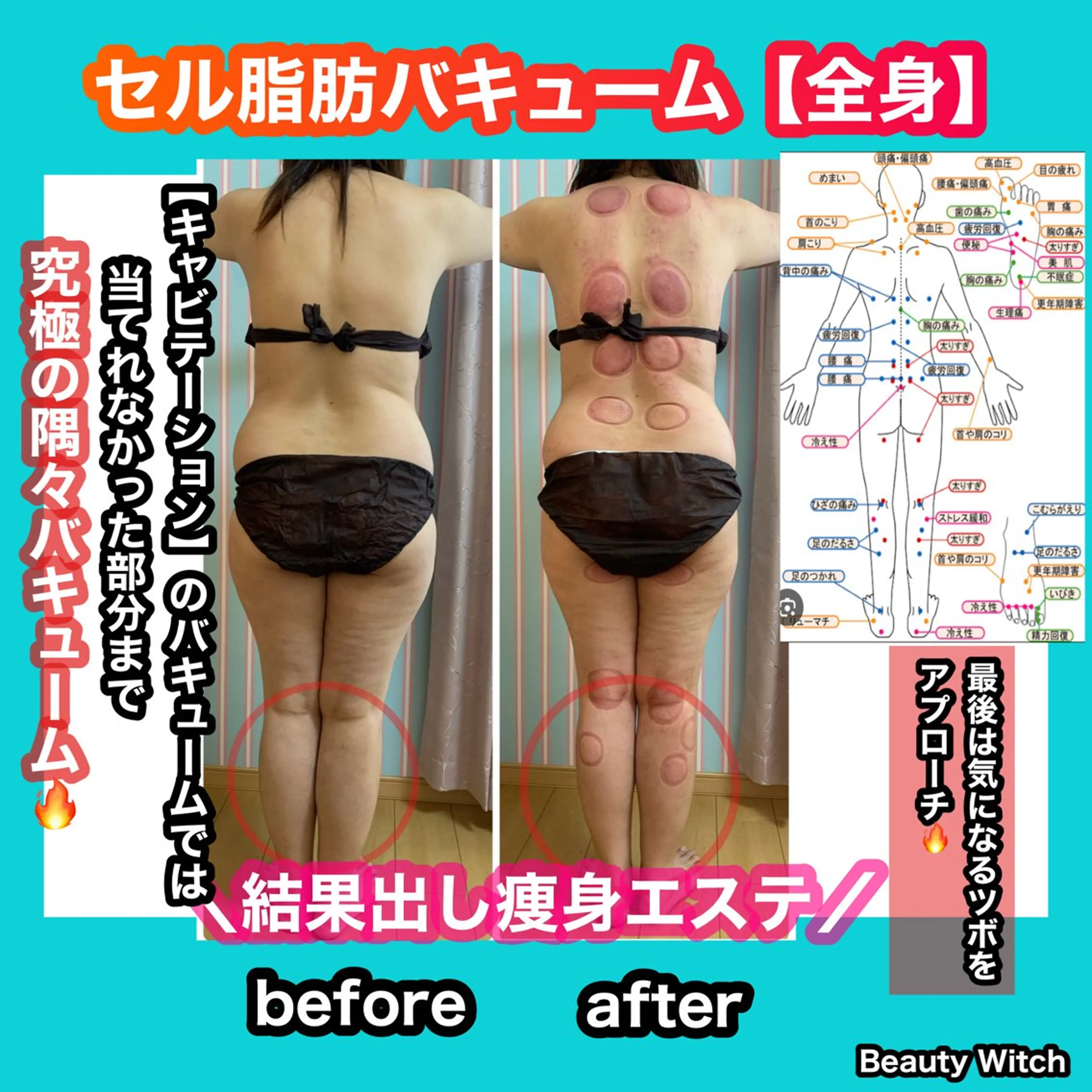 痩身/脱毛/ネイル HARUKAのエステ・リラクイメージ