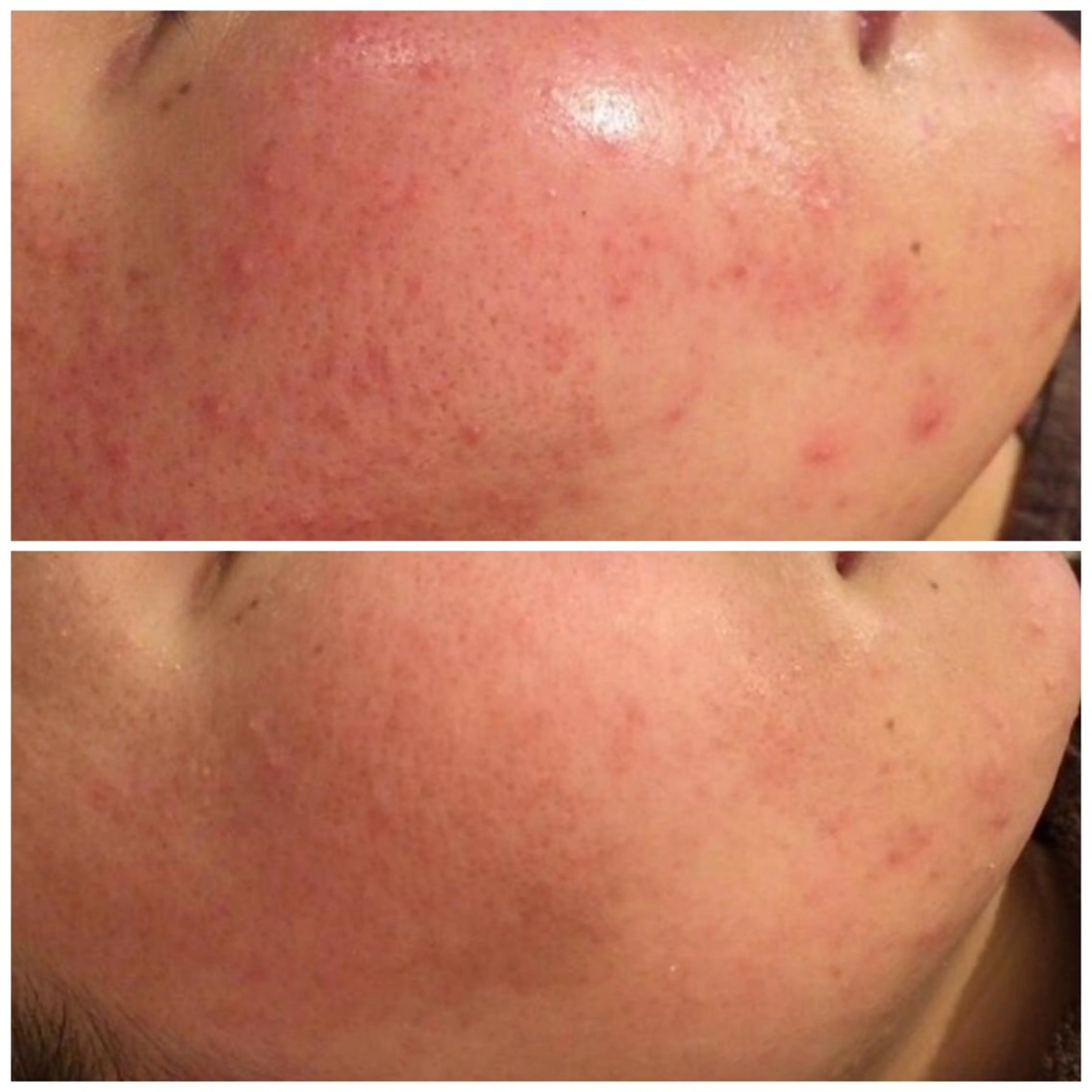 触れたくなる モテ肌へ...❤︎のエステ・リラクイメージ