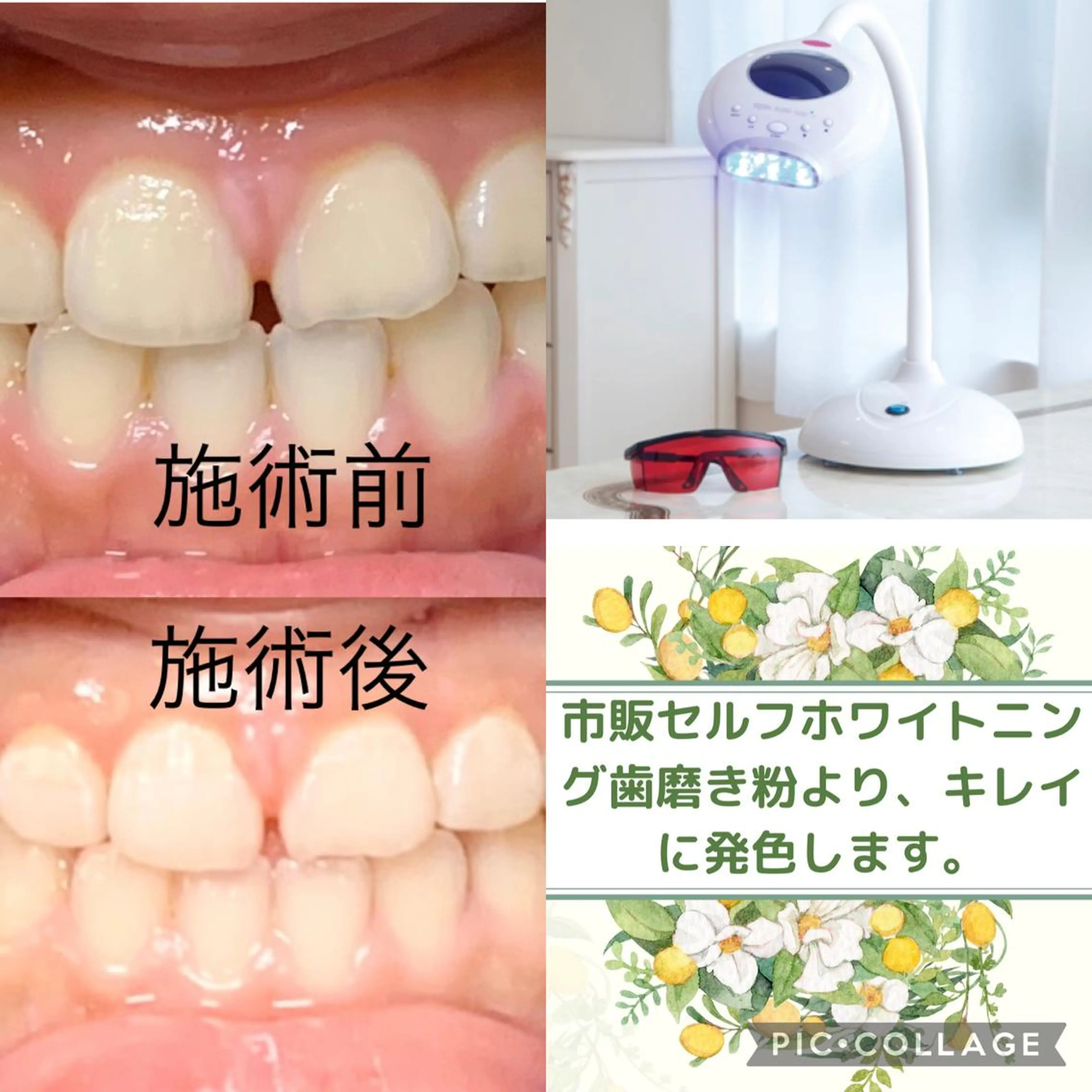 整体フェイシャル EMINALのエステ・リラクイメージ