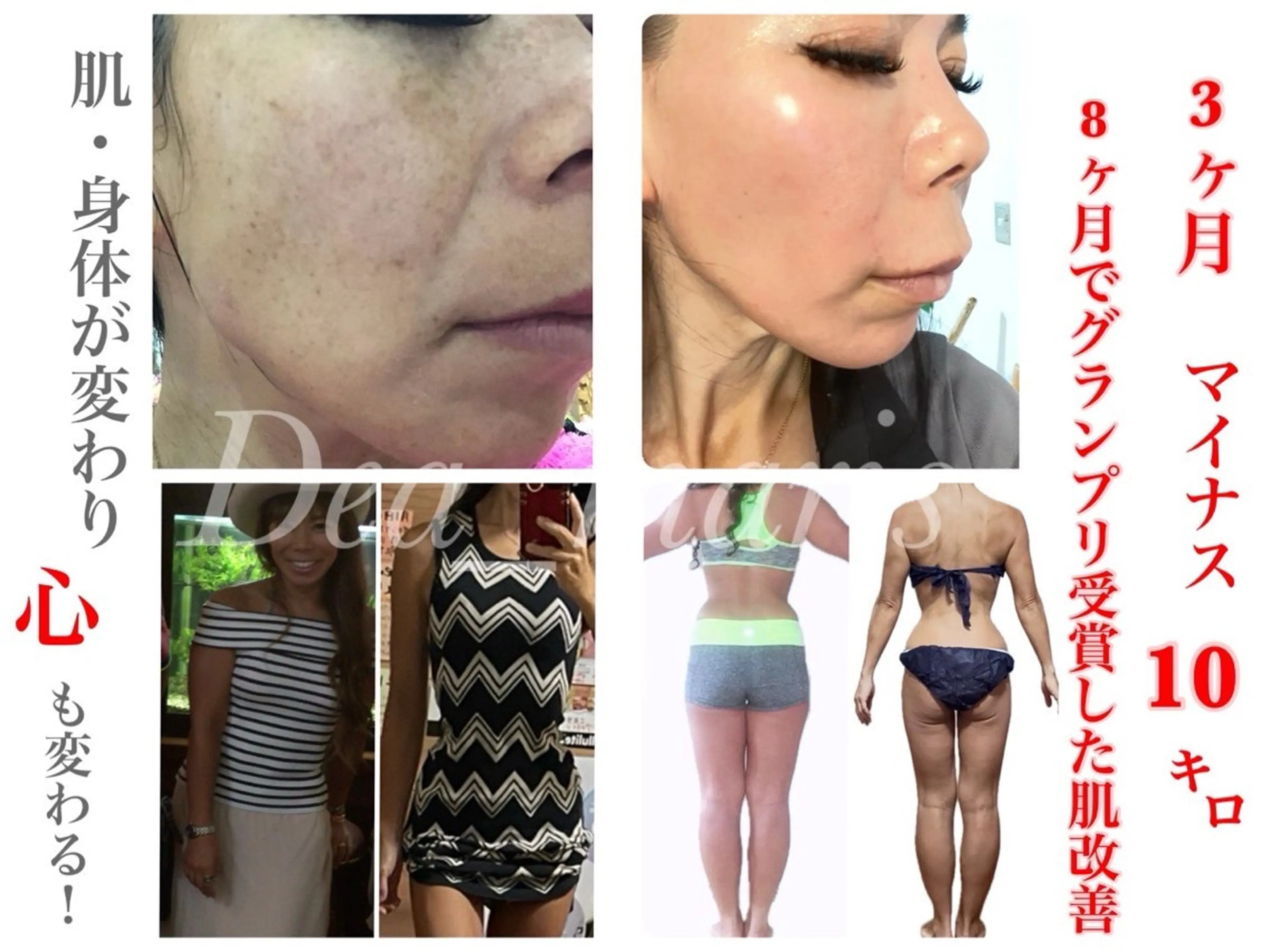 private salon  Dea_maris シュガーリング＆パーソナルボディケア所属・シミ改善・韓国肌管理 ボディメイク痩身のその他イメージ