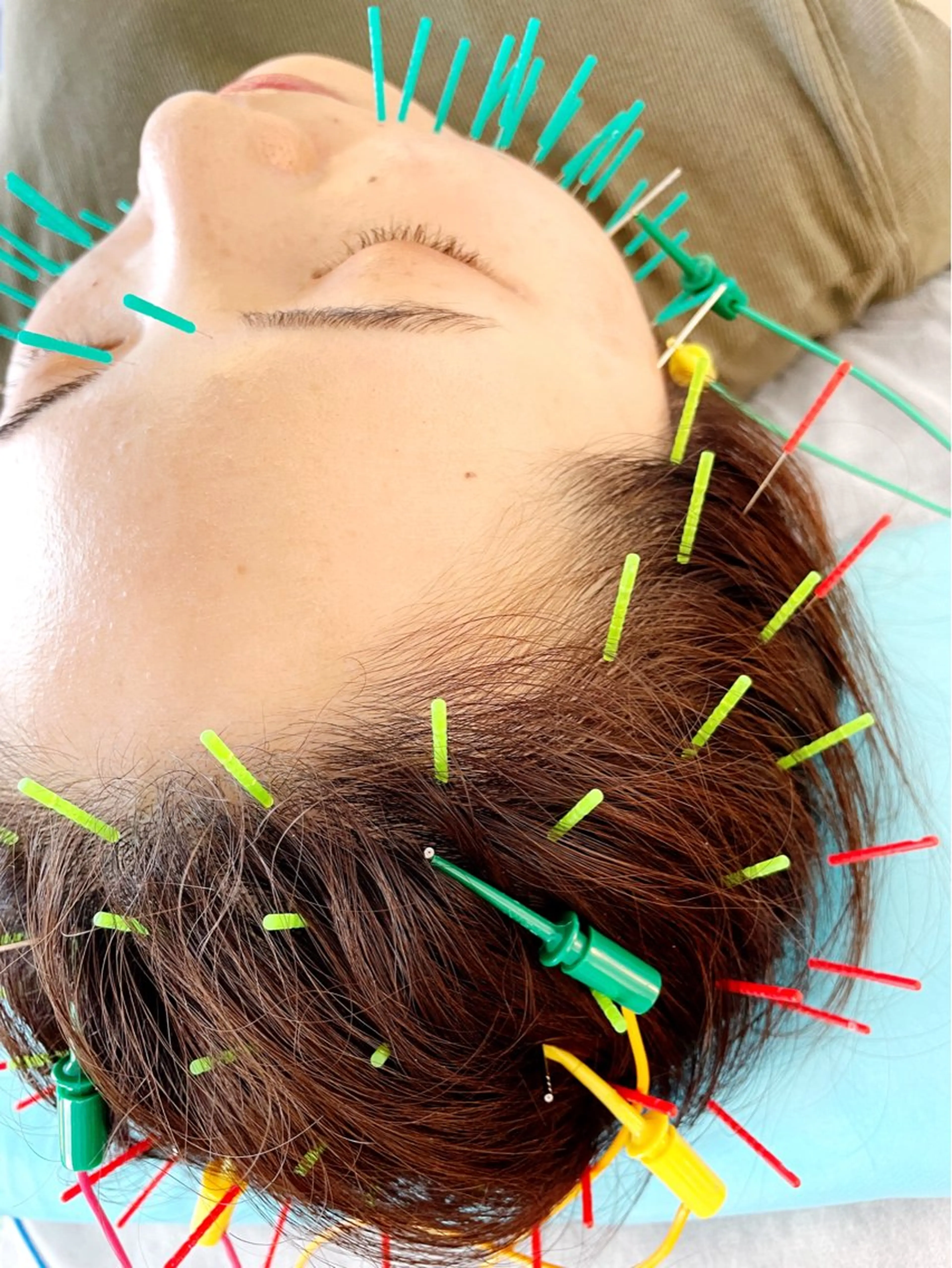 エステ リラク 小顔美容鍼専門サロン 渋谷YZのエステ・リラクイメージ