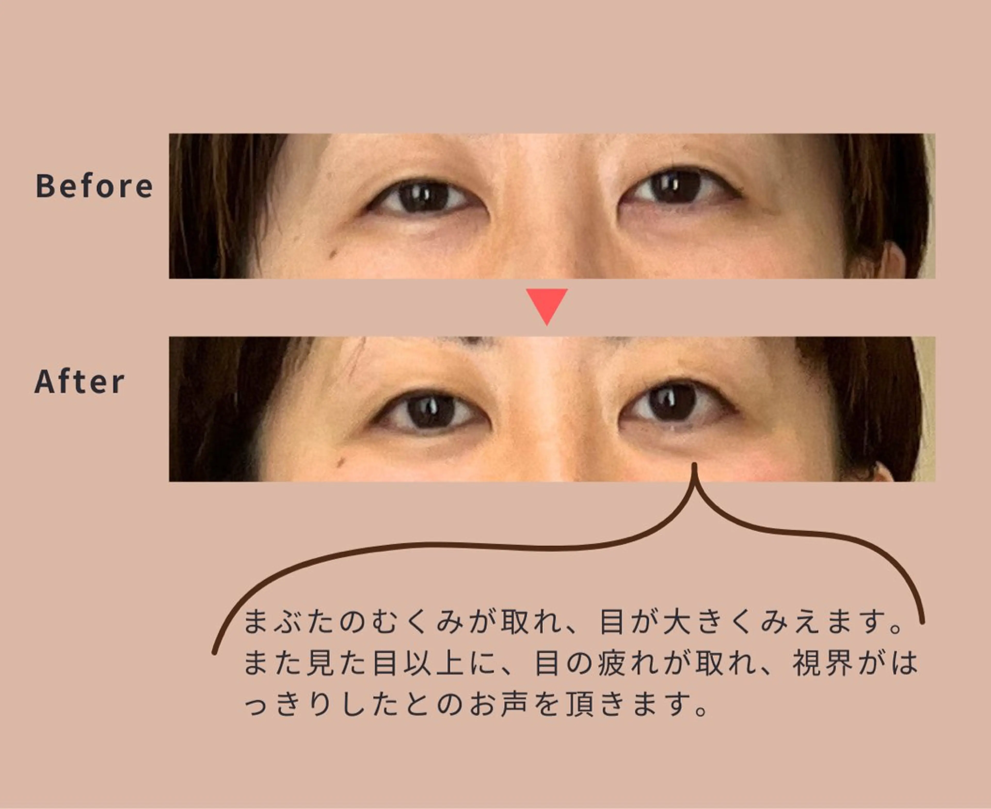 【初回限定】目元が気になる方に　眼精疲労回復コースの写真