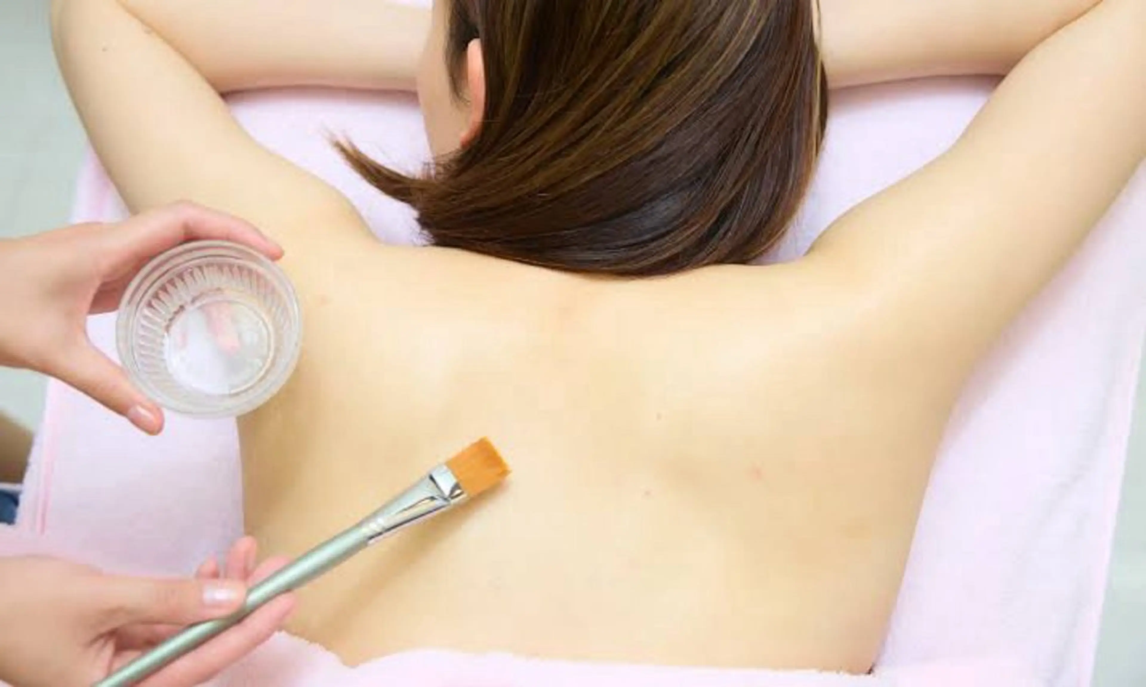 AHA グリコール酸ピーリング 【背中】 背中ニキビ/デコルテ/コメド/くすみ/毛穴の写真