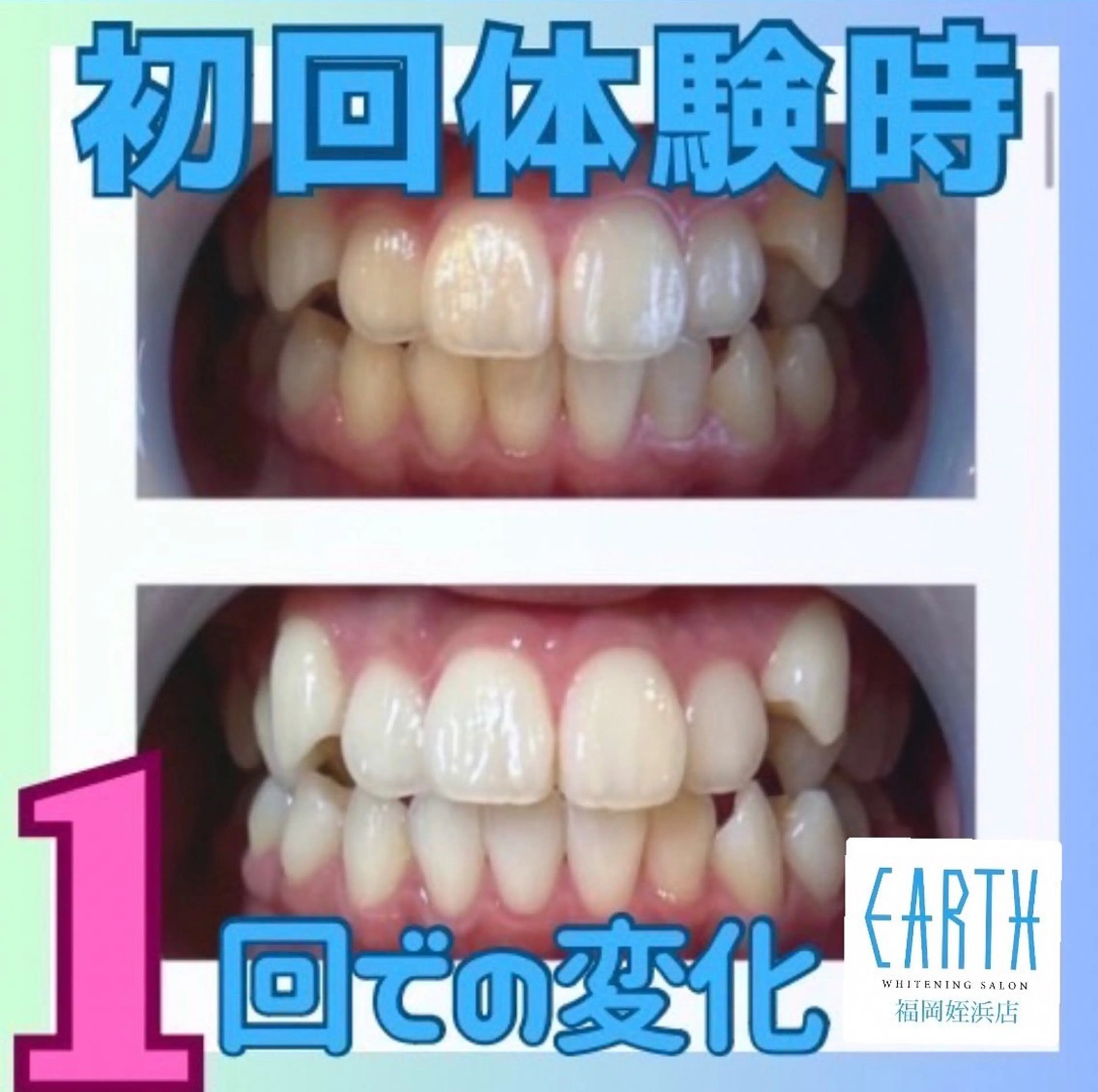 メンズ ホワイトニングサロン EARTH福岡姪浜店のその他イメージ