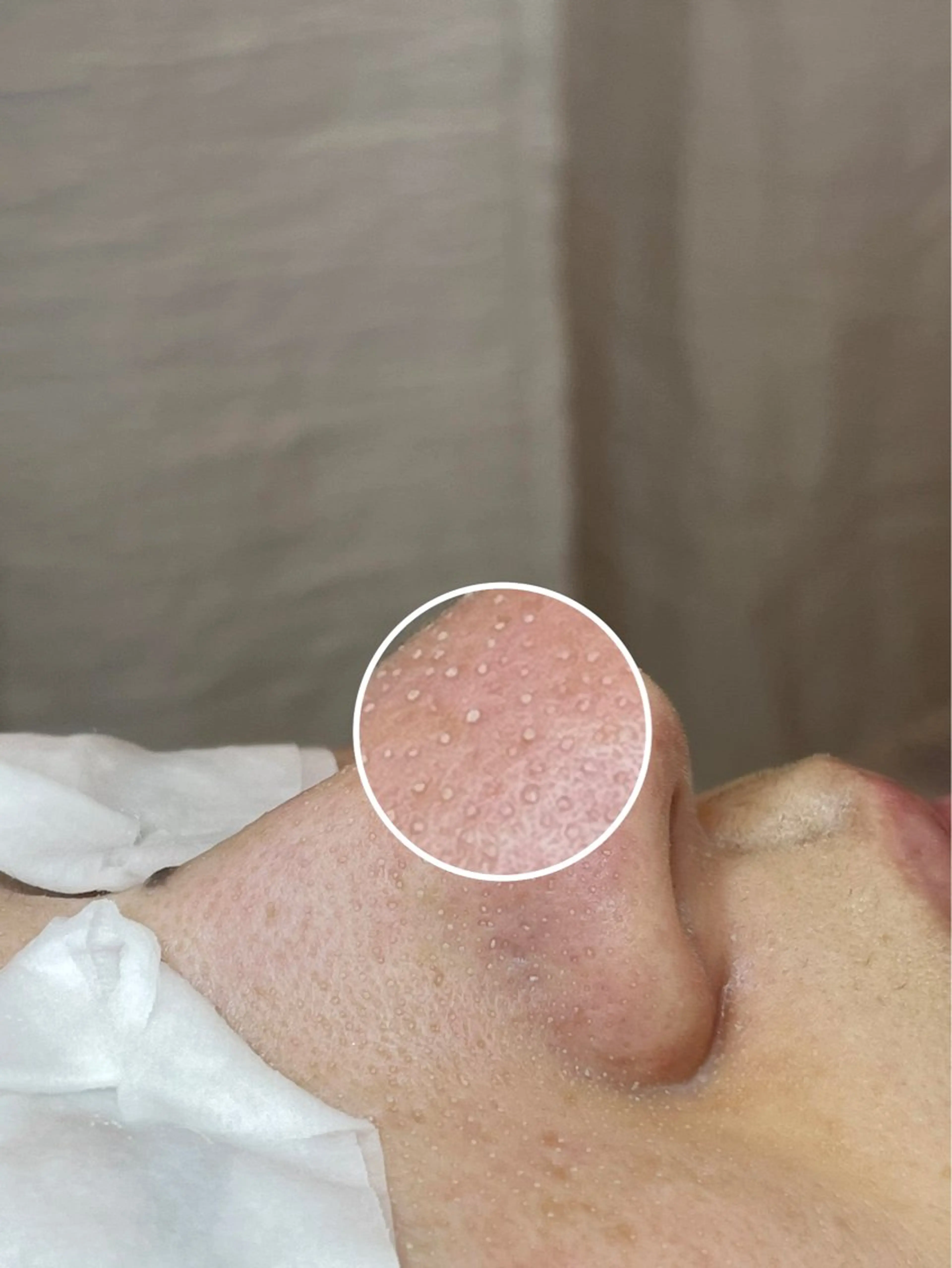 ulu 眉毛ハーブ毛穴肌改善の眉毛・アイブロウイメージ