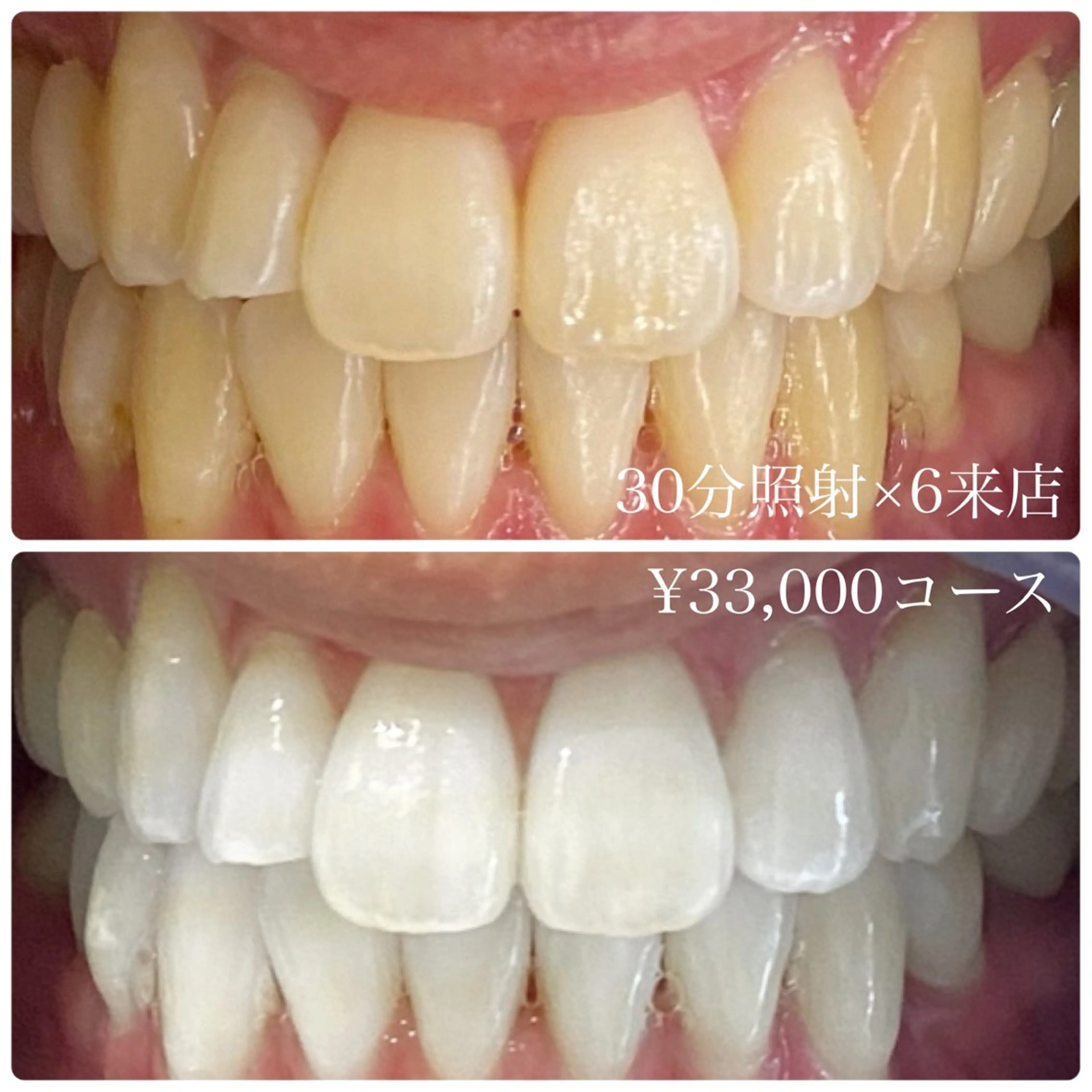 メンズ キッズ その他 ホワイトニングルーム　川崎店所属・ホワイトニング ルーム　川崎店のその他イメージ