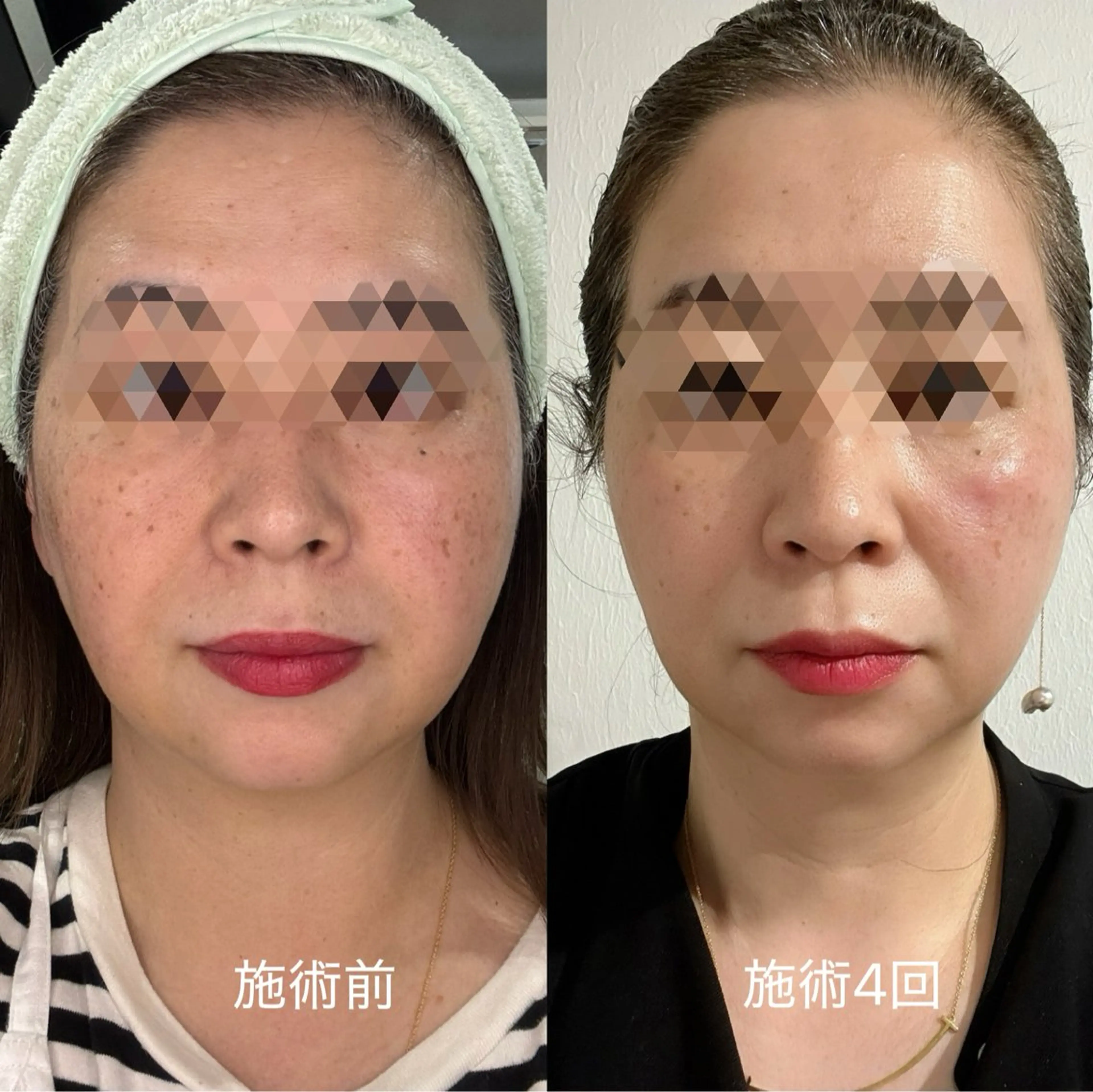 エステ 肌質改善サロンand...所属・肌質改善サロン and...のエステ・リラクイメージ