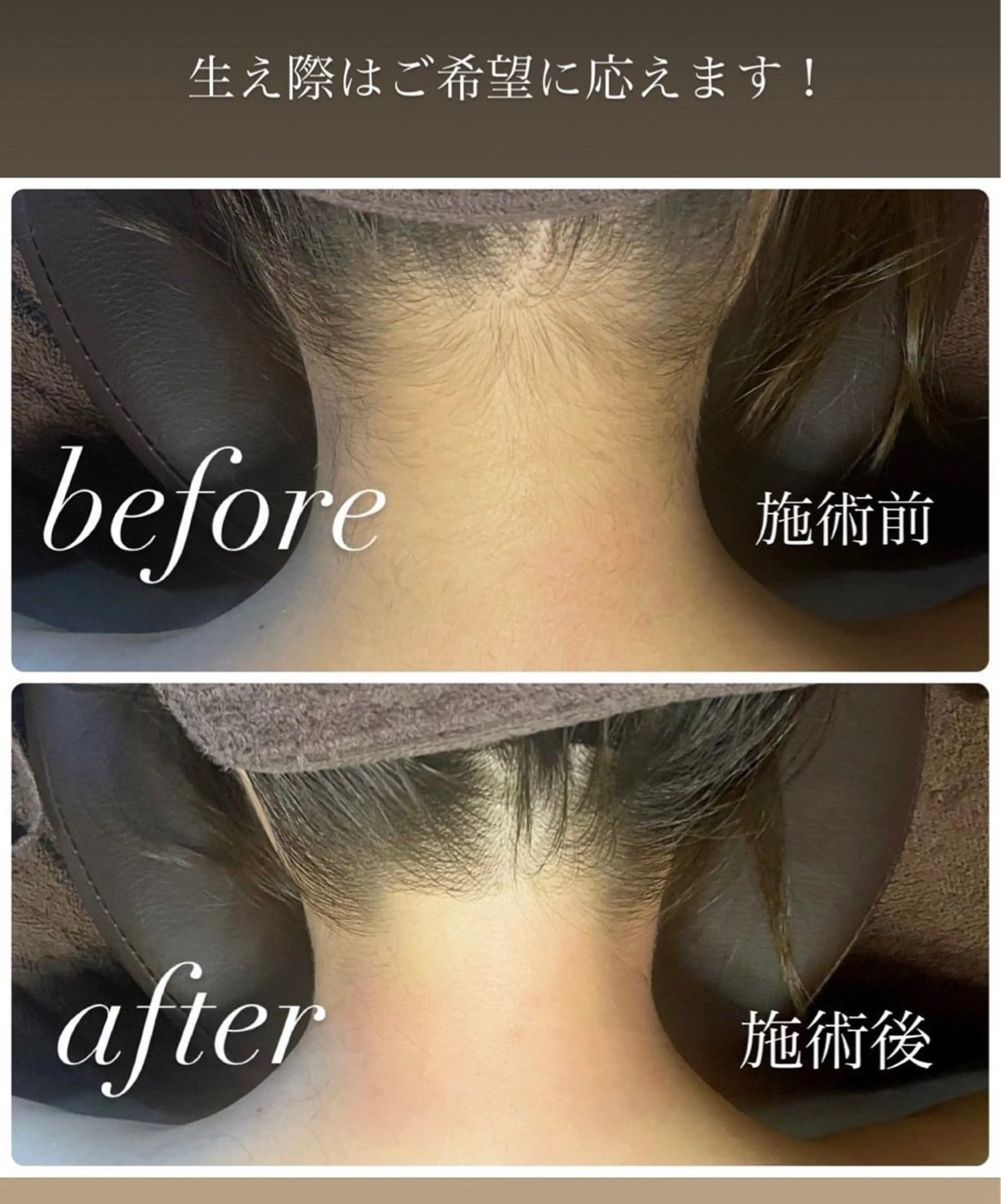 メンズ キッズ 脱毛🌈Beauty Salon新宿店のエステ・リラクイメージ