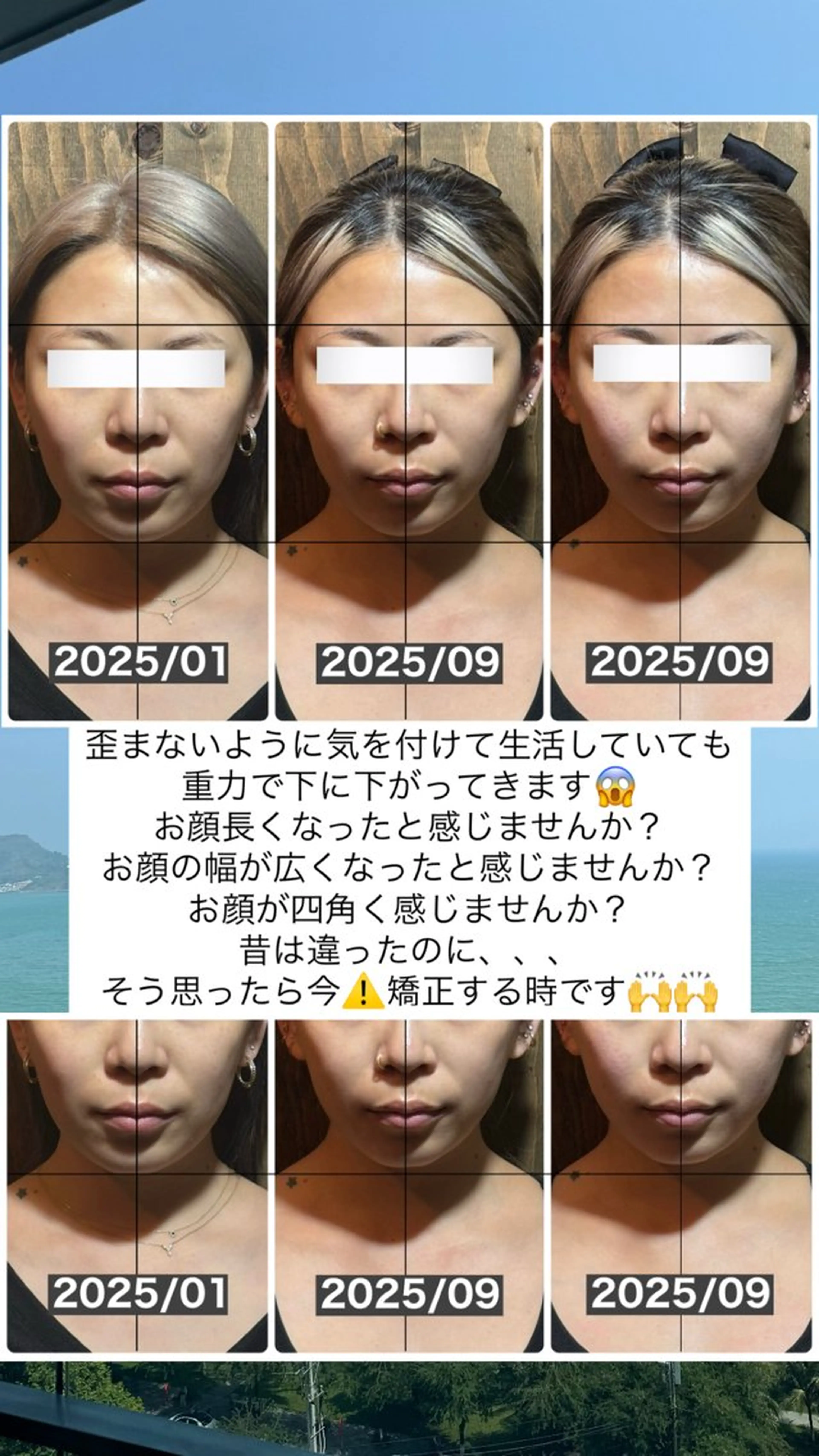 エステ リラク 💎後悔させない小顔 矯正💎イトヤマ🌱のエステ・リラクイメージ