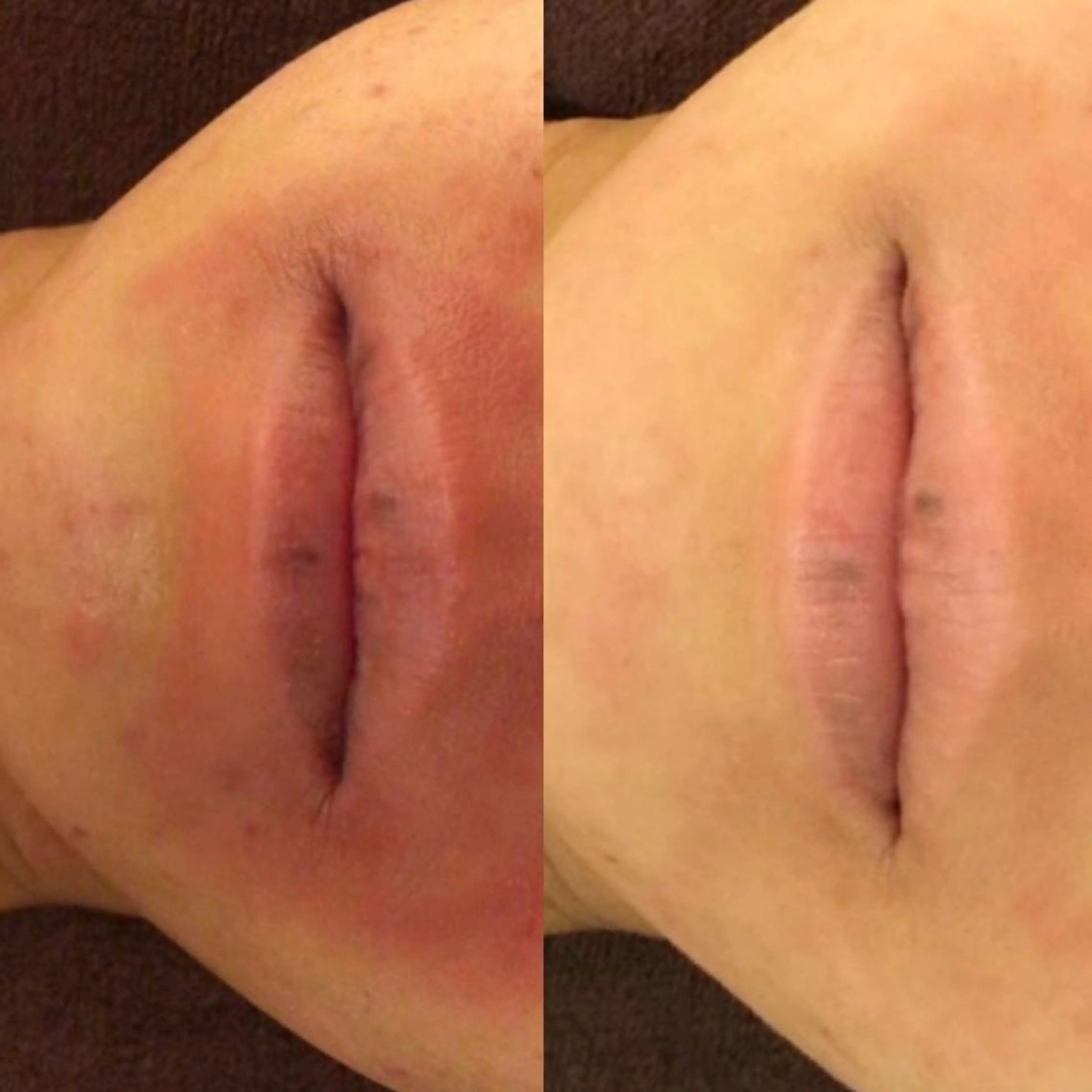 ニキビ経験者が施術 する専門サロン🌻のエステ・リラクイメージ