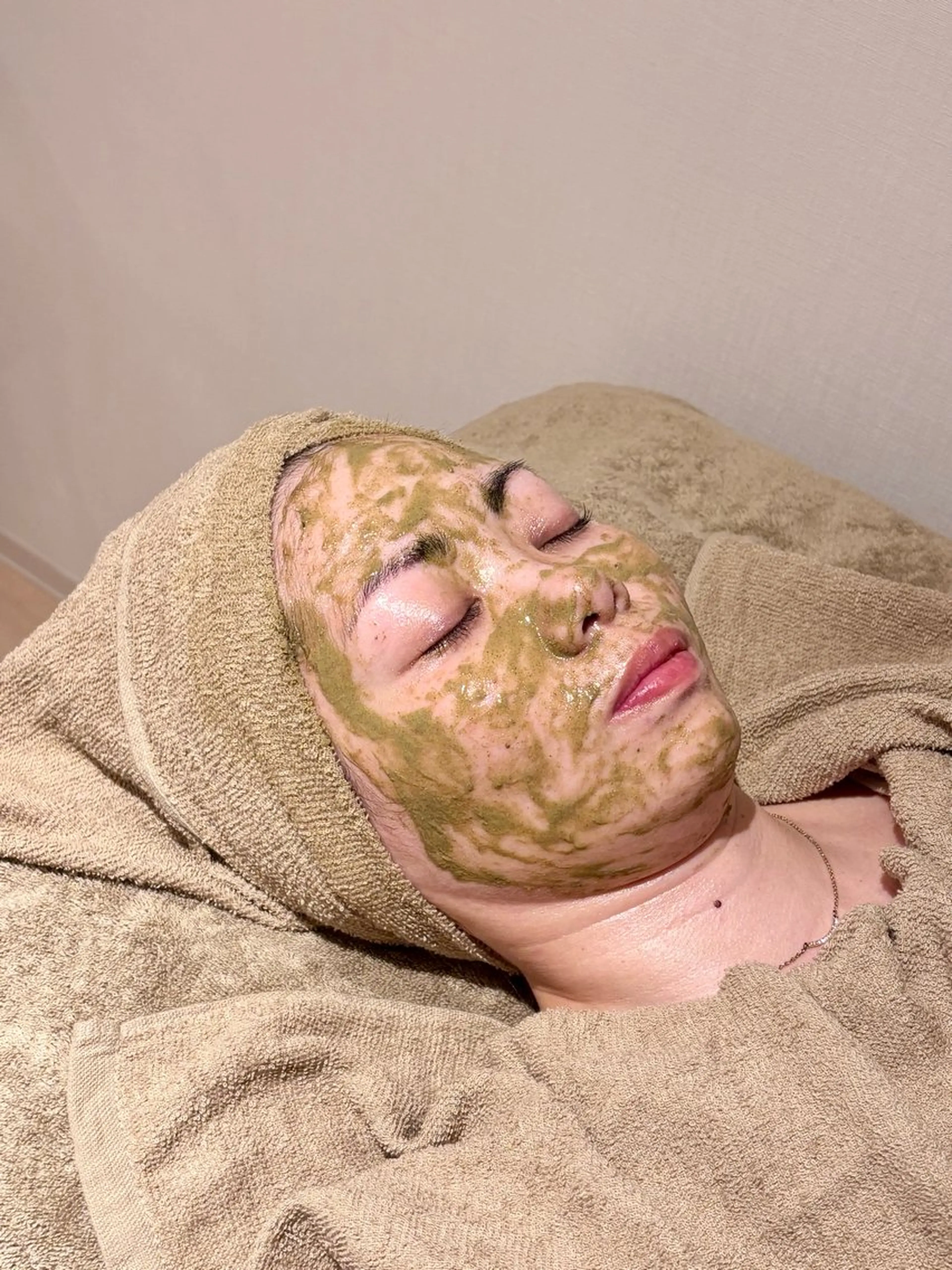 【人気No.1✨】🌿ハーブピーリング×小顔矯正💆‍♀️で美肌も小顔もGET‼️の写真