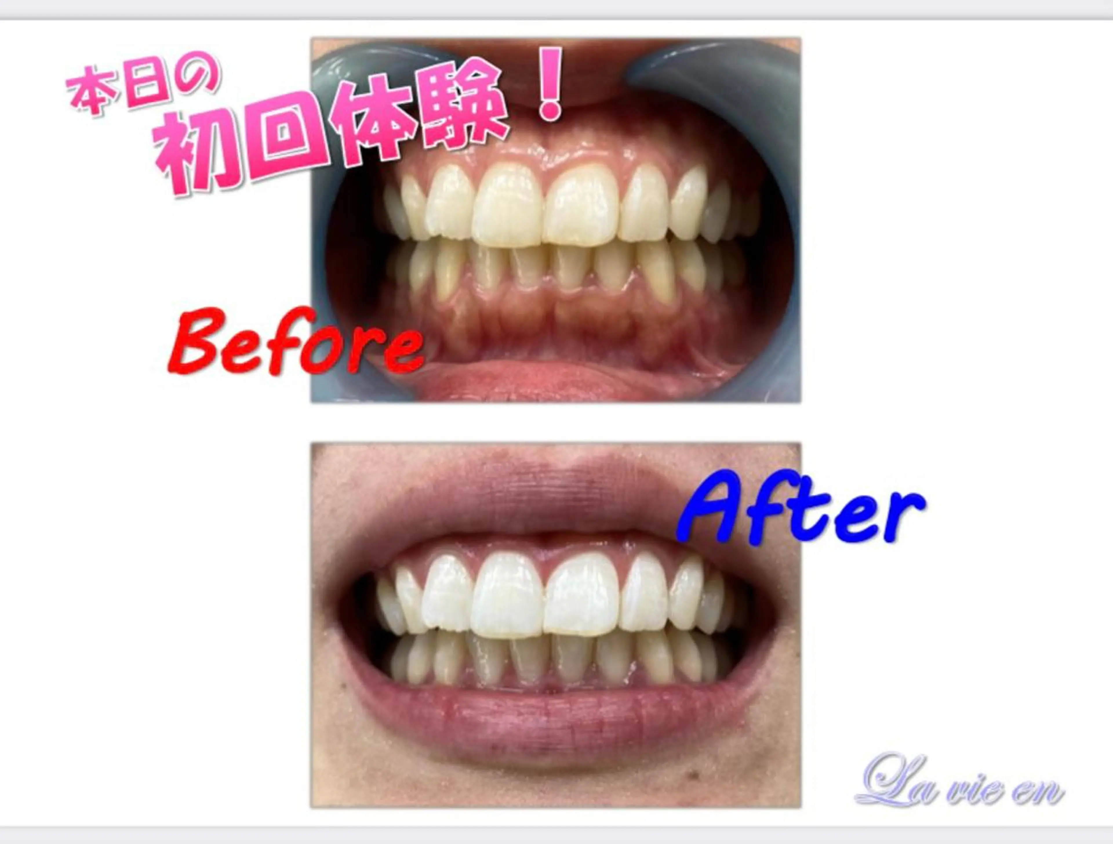 その他 セルフホワイトニングサロン　ラヴィアン所属・ホワイトニングサロン La vie enのその他イメージ
