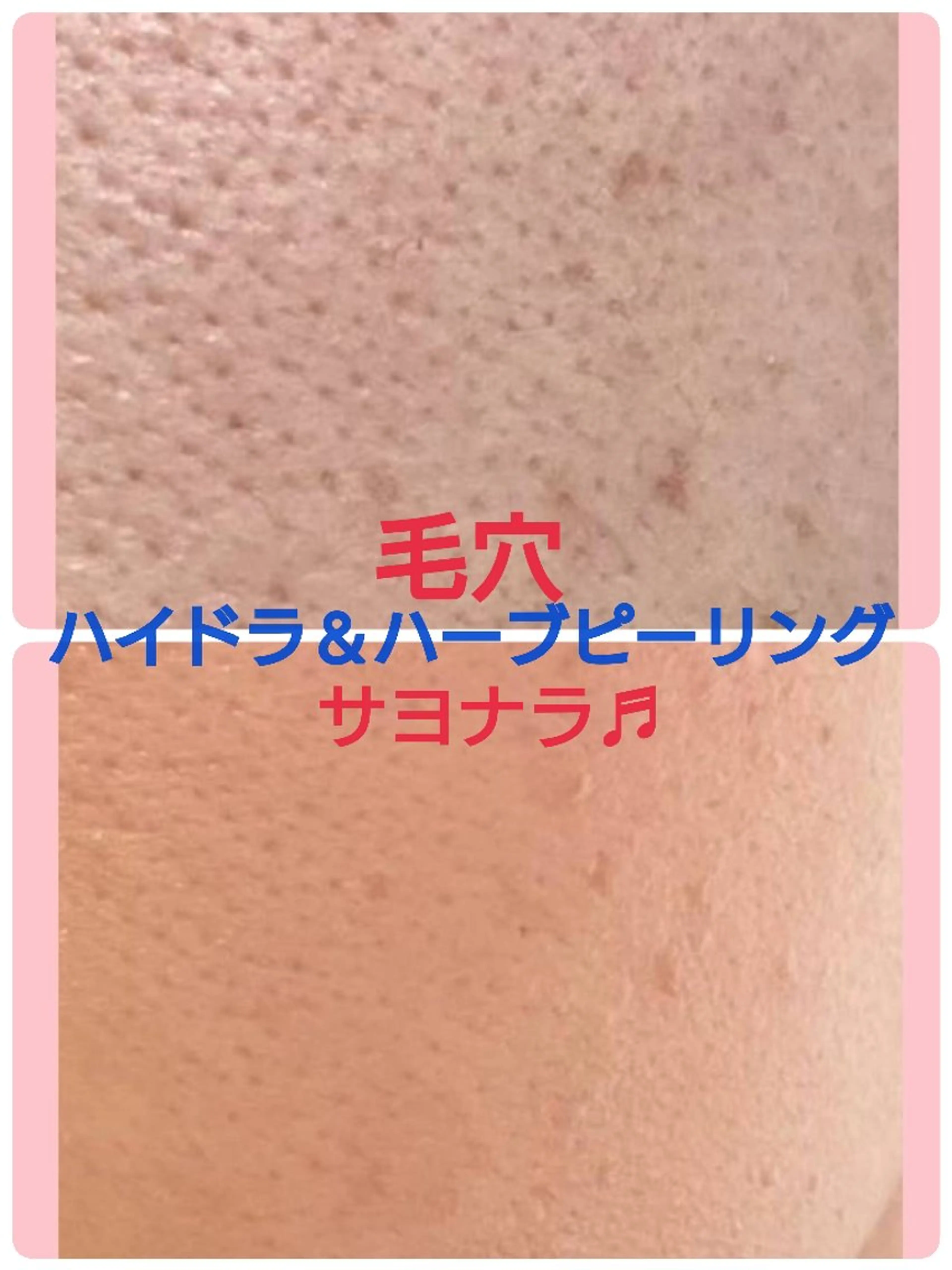 エステ ハーブピーリング 専門店Kikkaのエステ・リラクイメージ